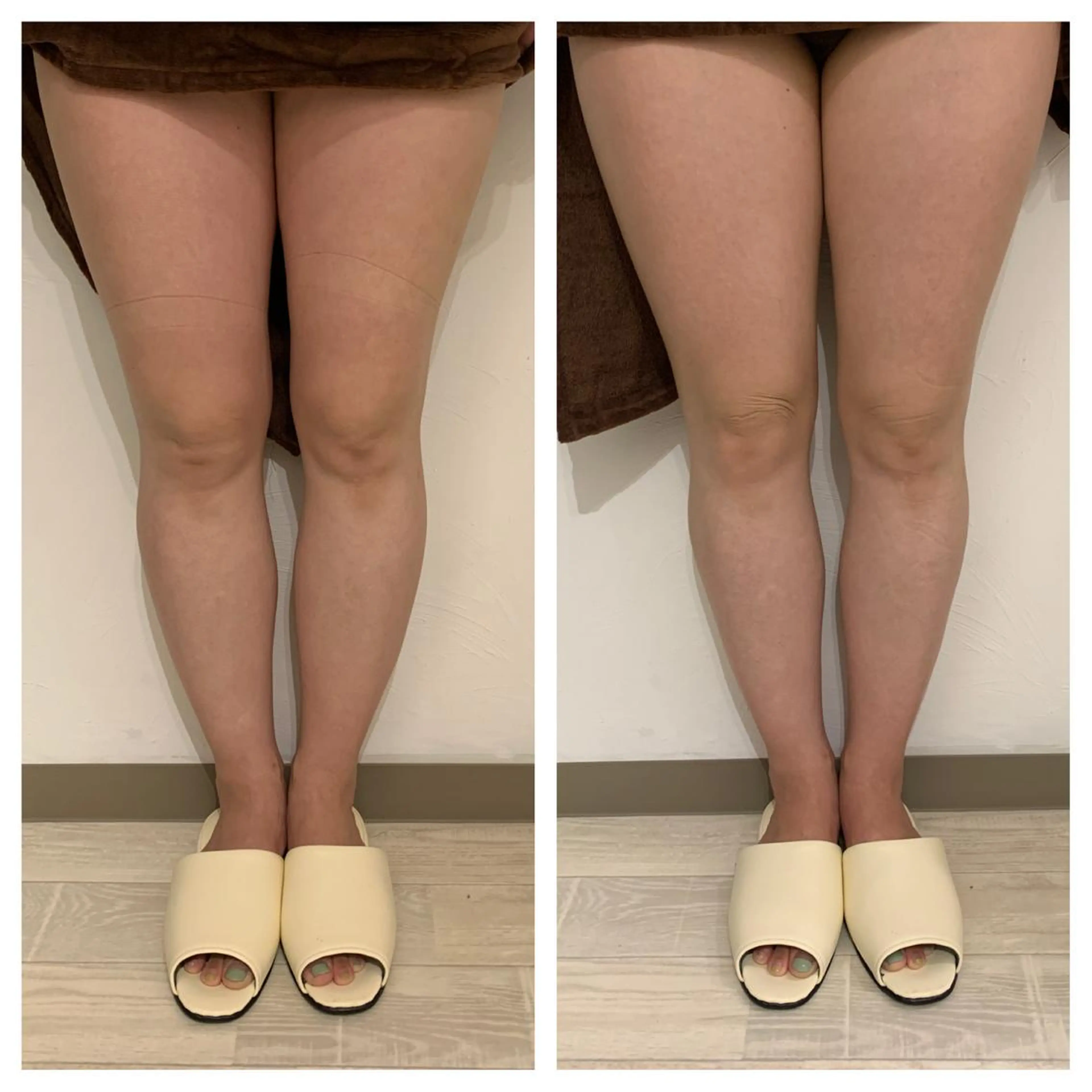 リンパマッサージ&ピラティスmimoza所属・リンパマッサージ mimozaのエステ・リラクイメージ