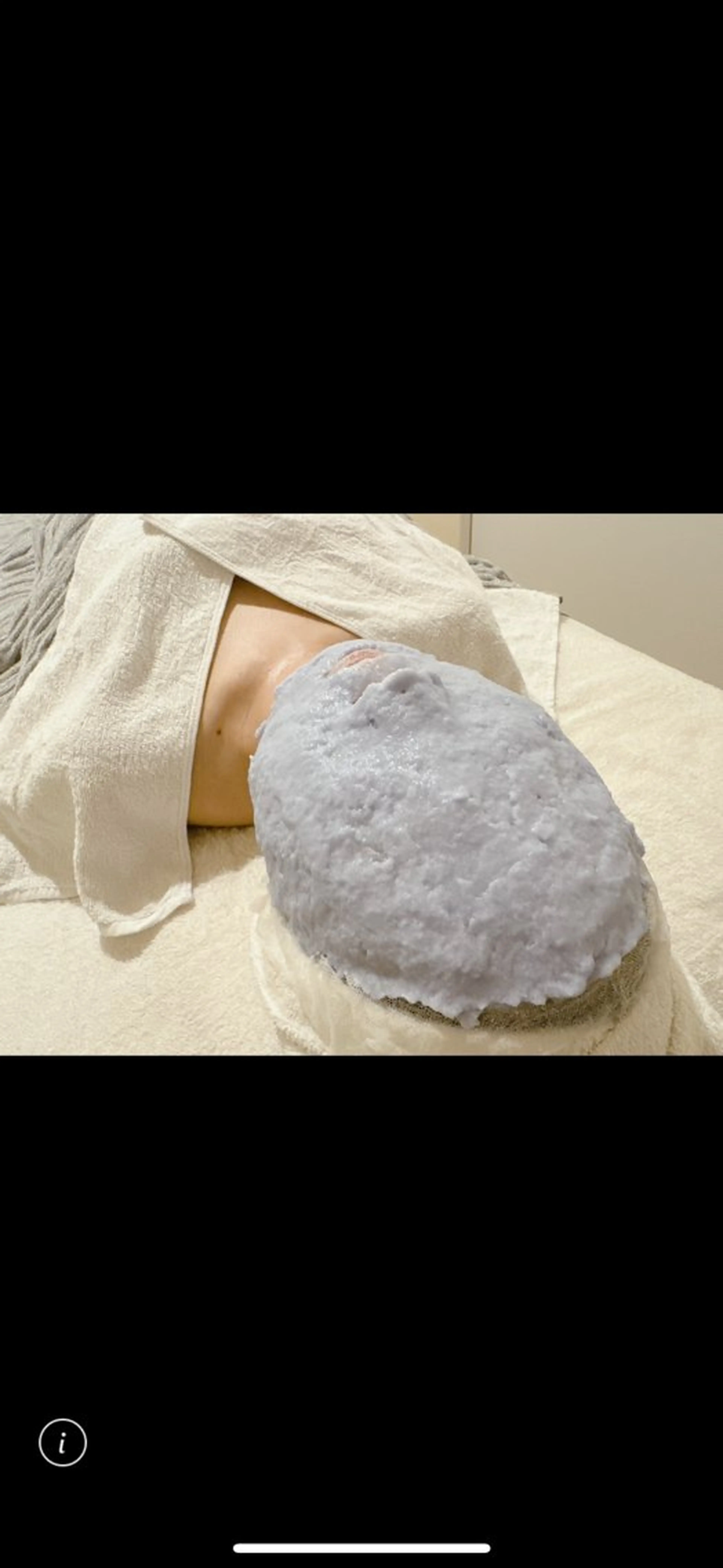 ディーププログラム《BAホワイトニングケア》の写真