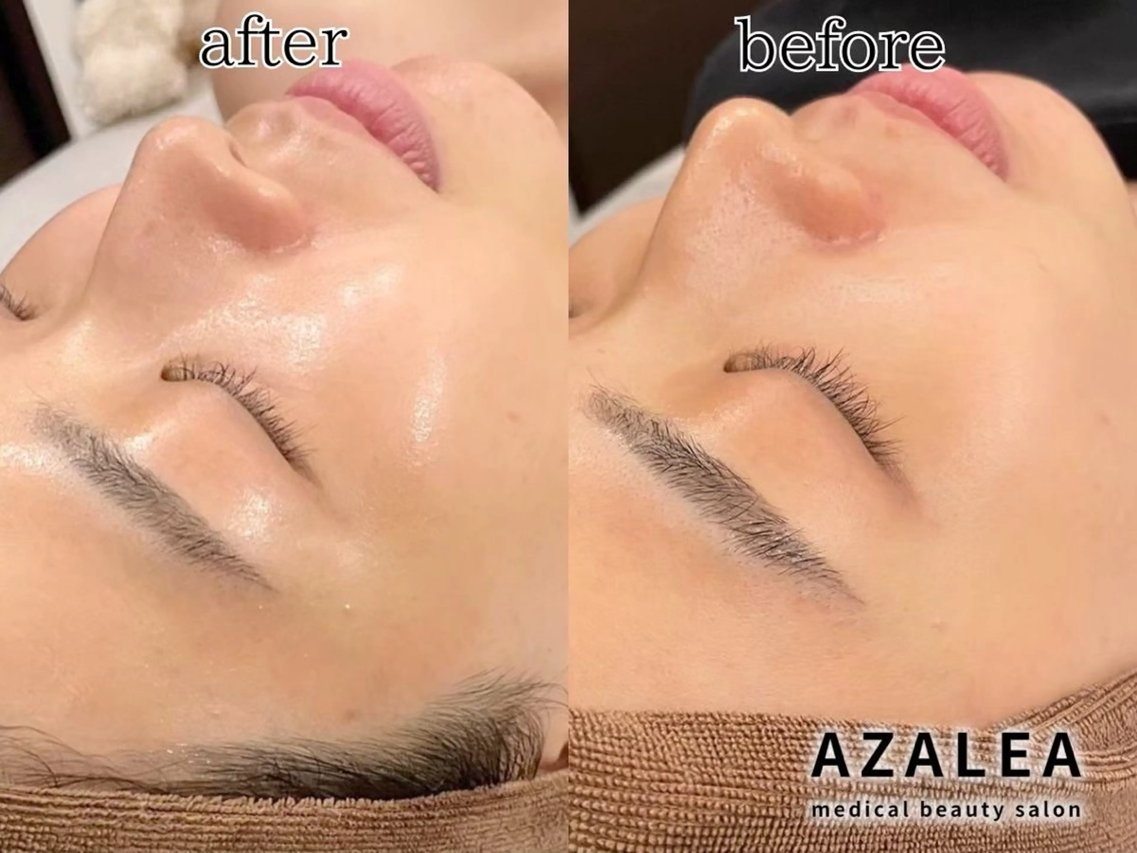 medical salon AZALEA 新宿店所属・牛込 桃香のエステ・リラクイメージ