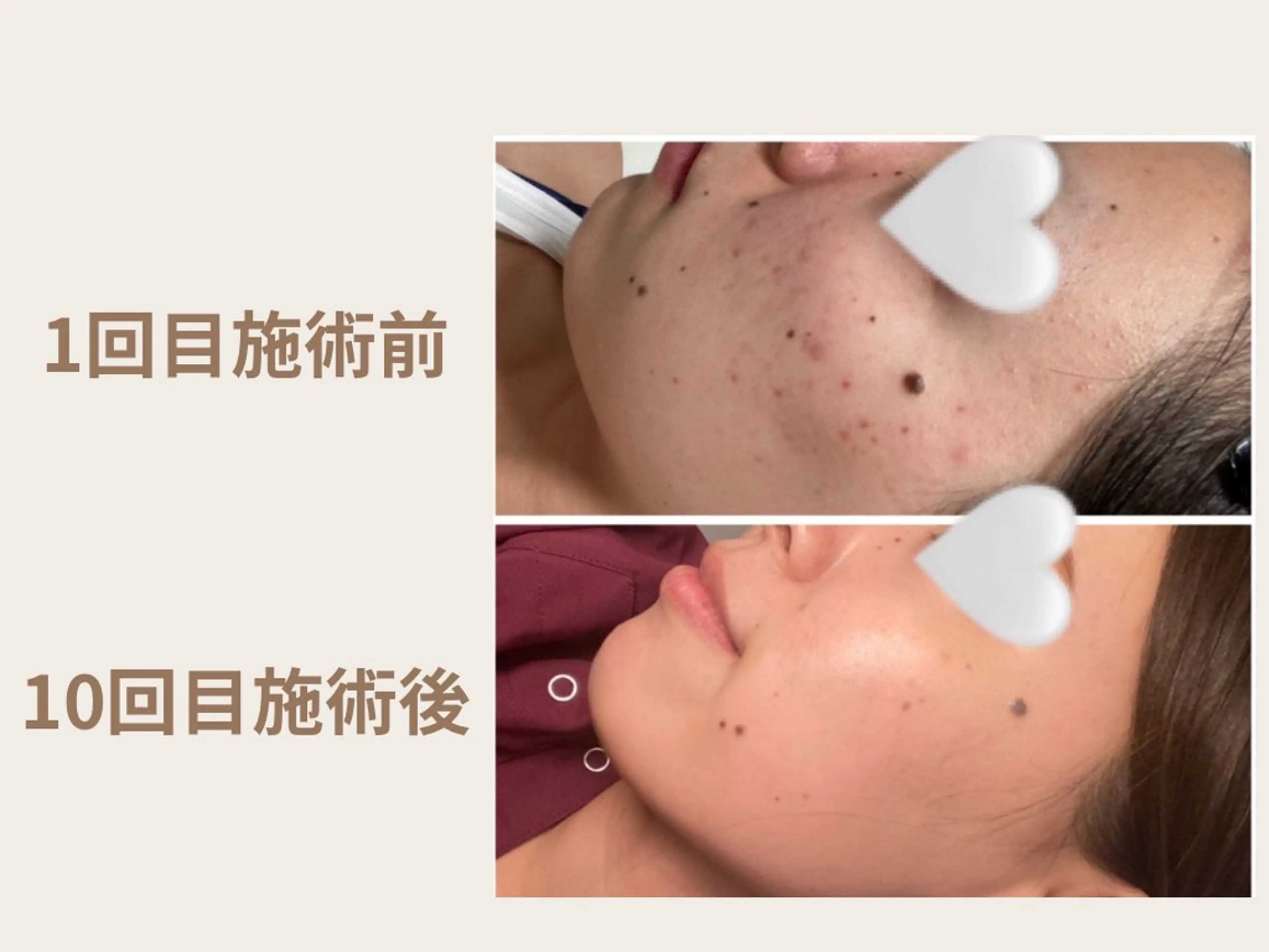 Momose Hanaのエステ・リラクイメージ