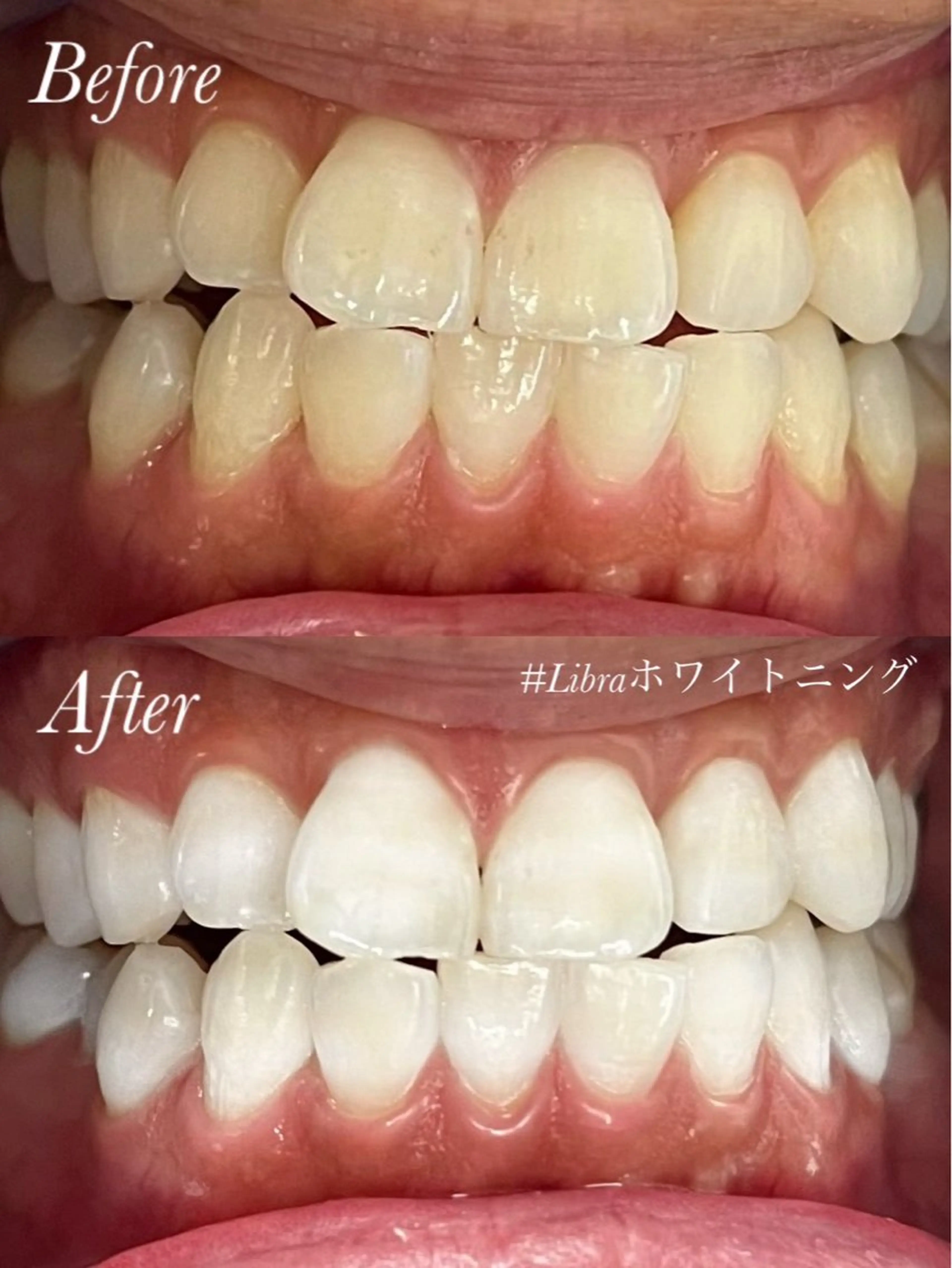 LIBRAセルフホワイトニングサロン高槻本店所属・龍野 みどりのその他イメージ