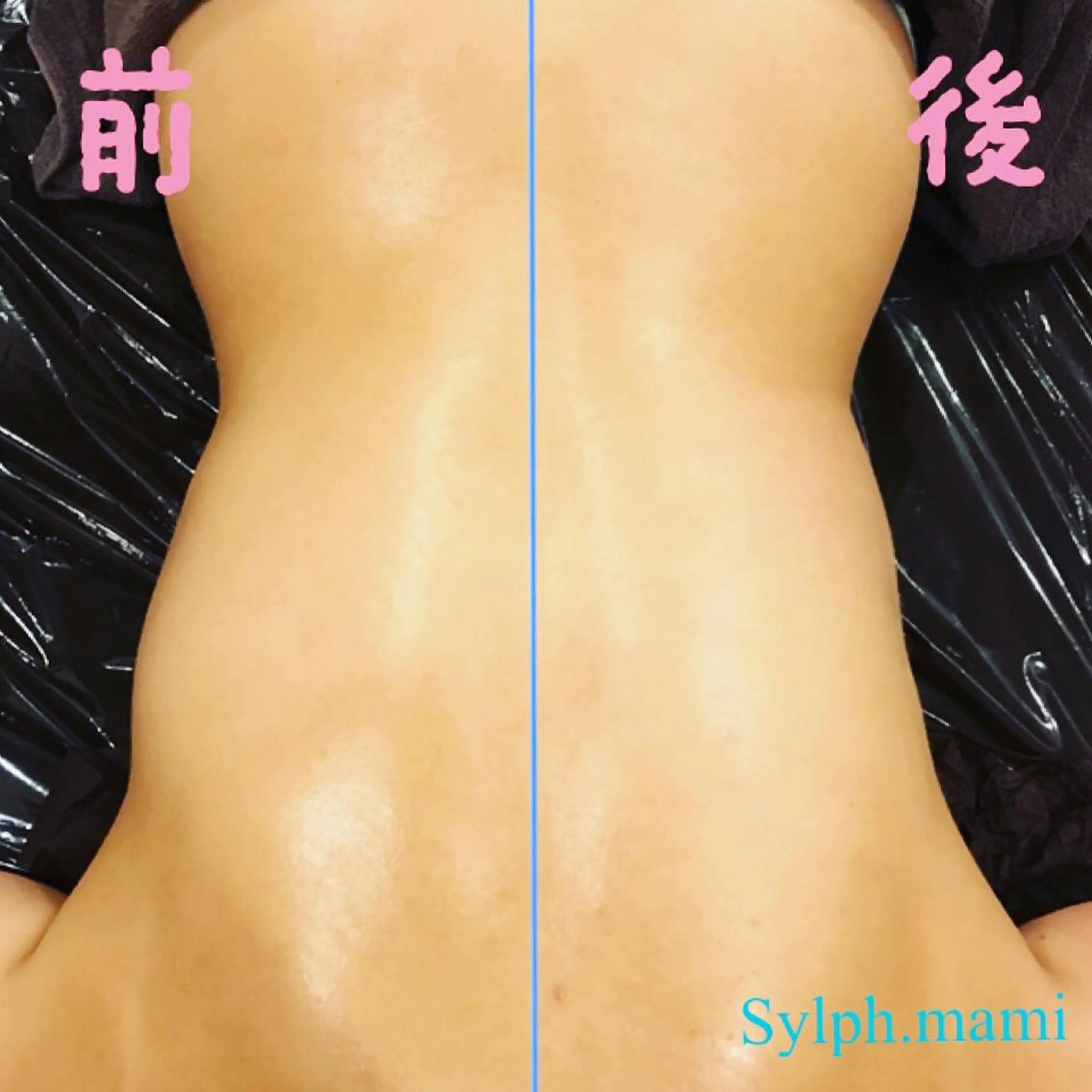 毒素出し専門サロンSylph(なかがわ整骨院併設サロン)所属・Mami Hataのエステ・リラクイメージ