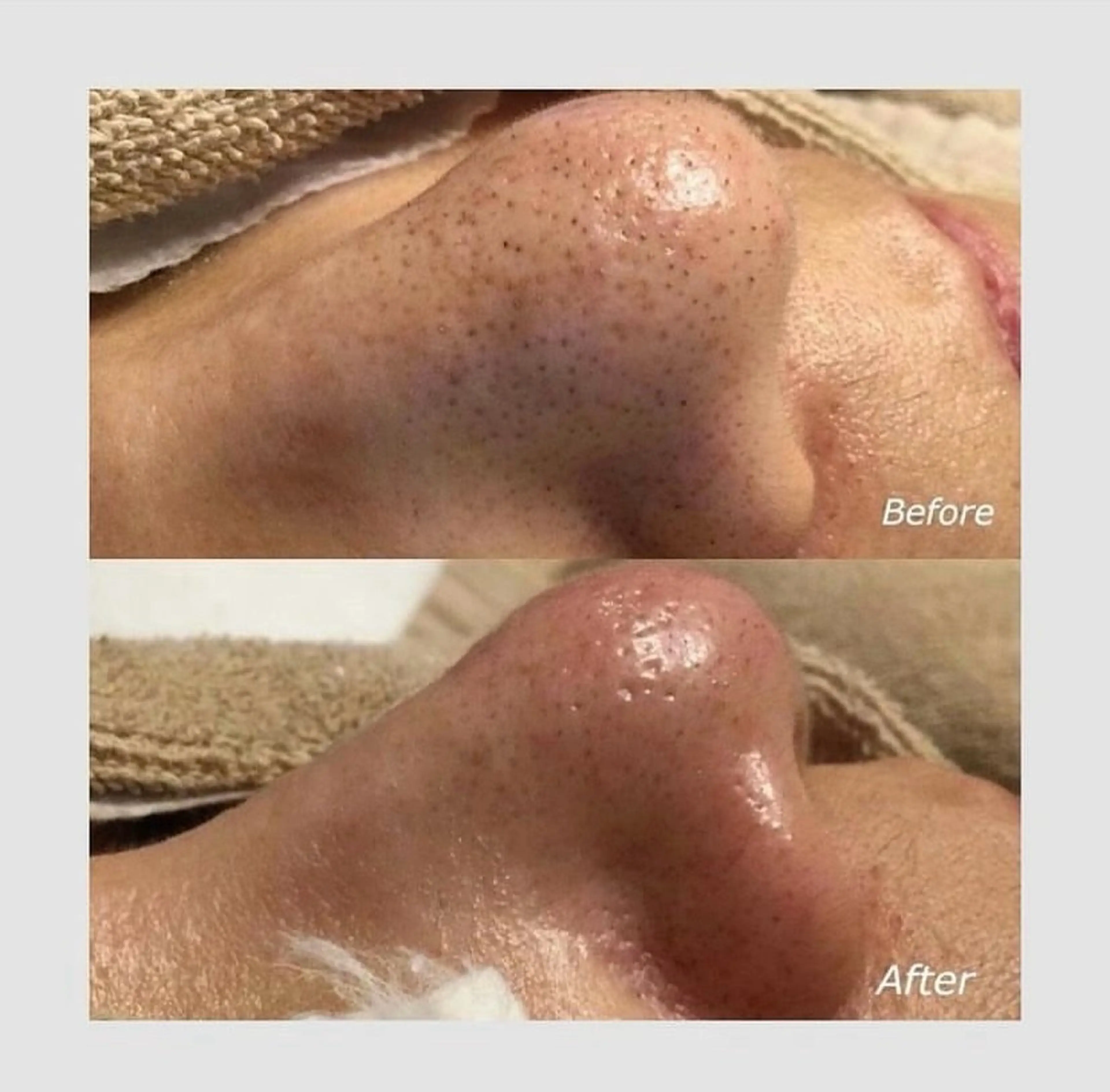 韓国肌管理 【毛穴専科】のエステ・リラクイメージ