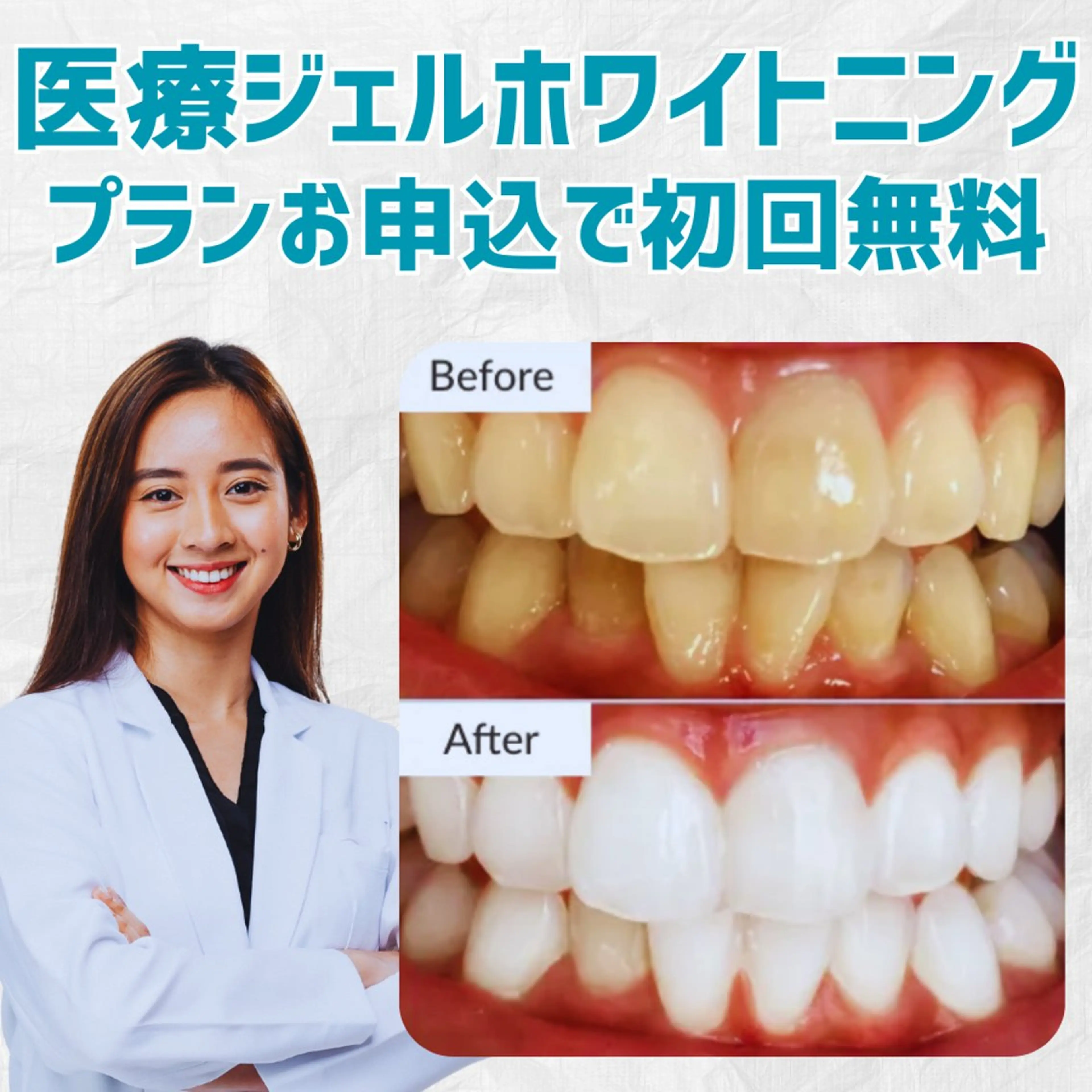 カラー その他 スマイルホワイト 赤羽店のエステ・リラクイメージ