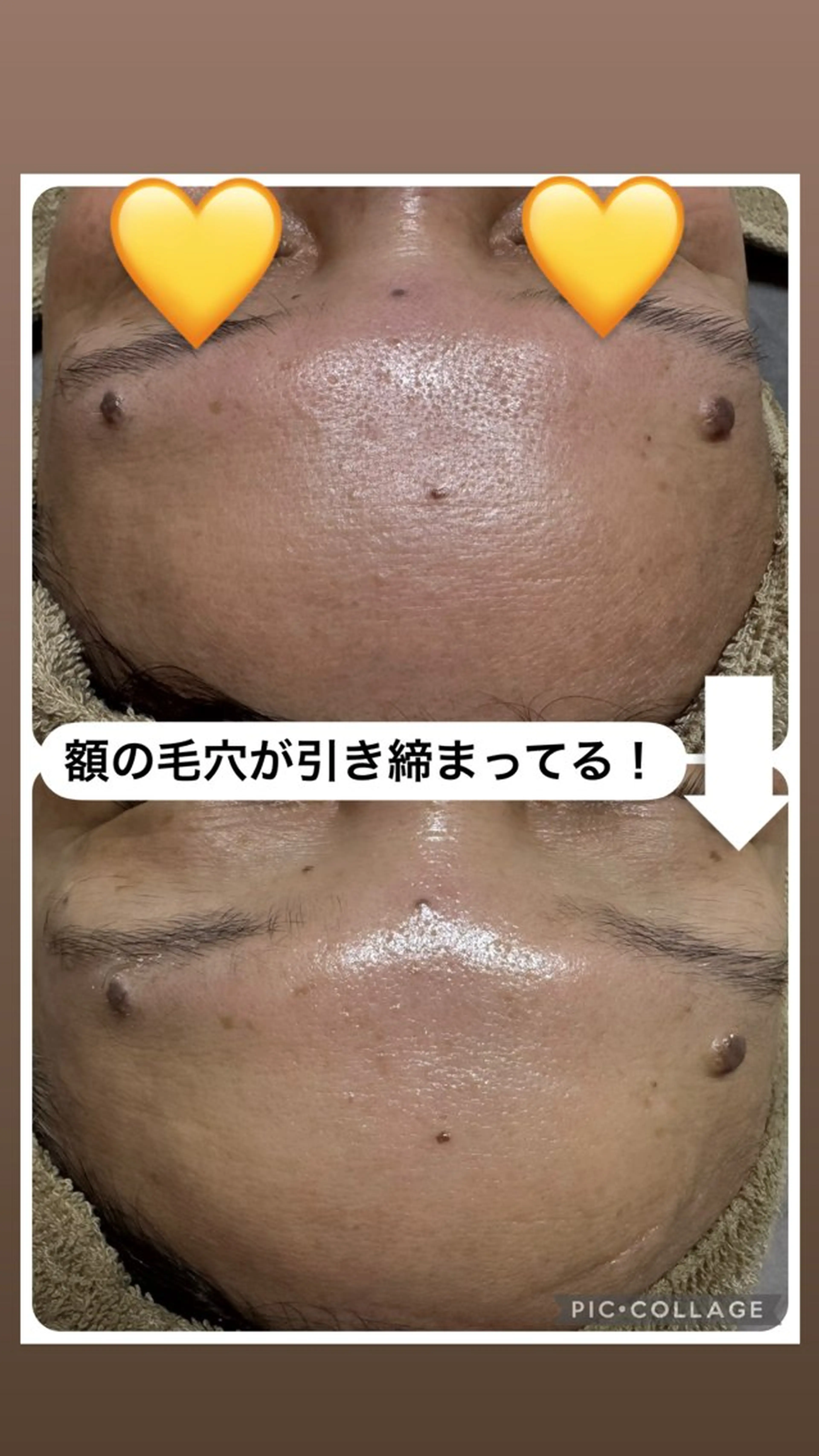 W MISATOのエステ・リラクイメージ