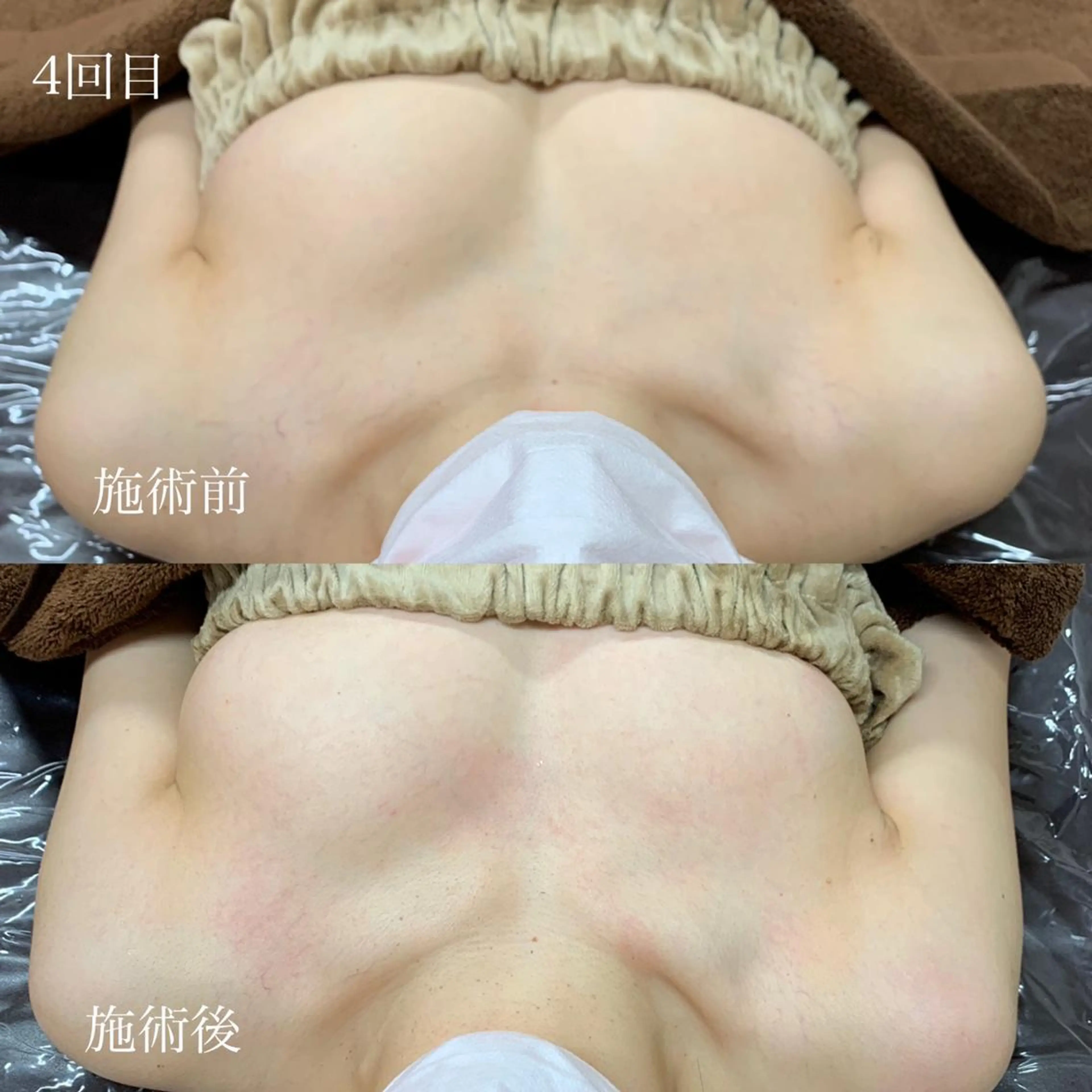 リラクゼーション サロンせいらんのエステ・リラクイメージ