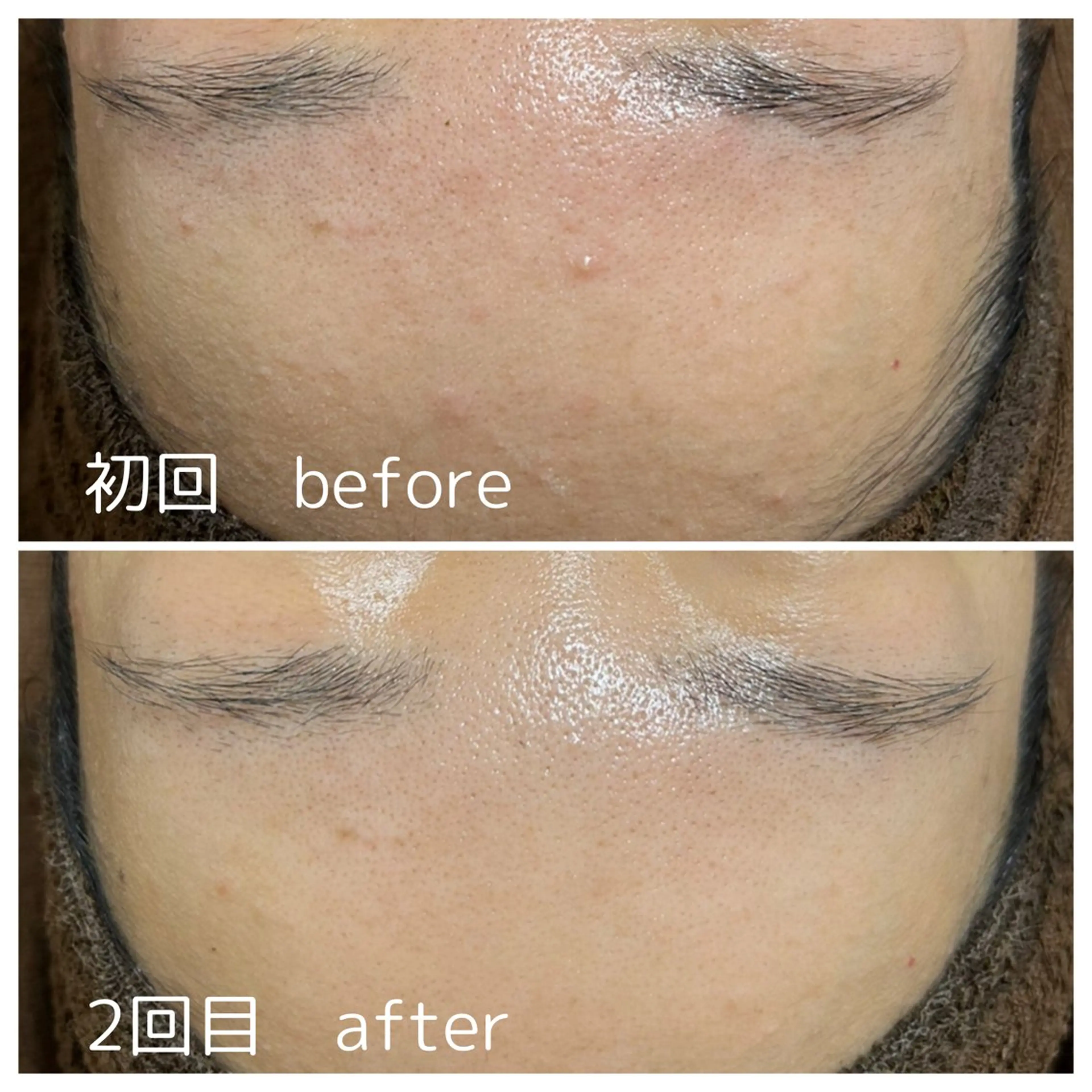 エステ 永田 利佳子のその他イメージ