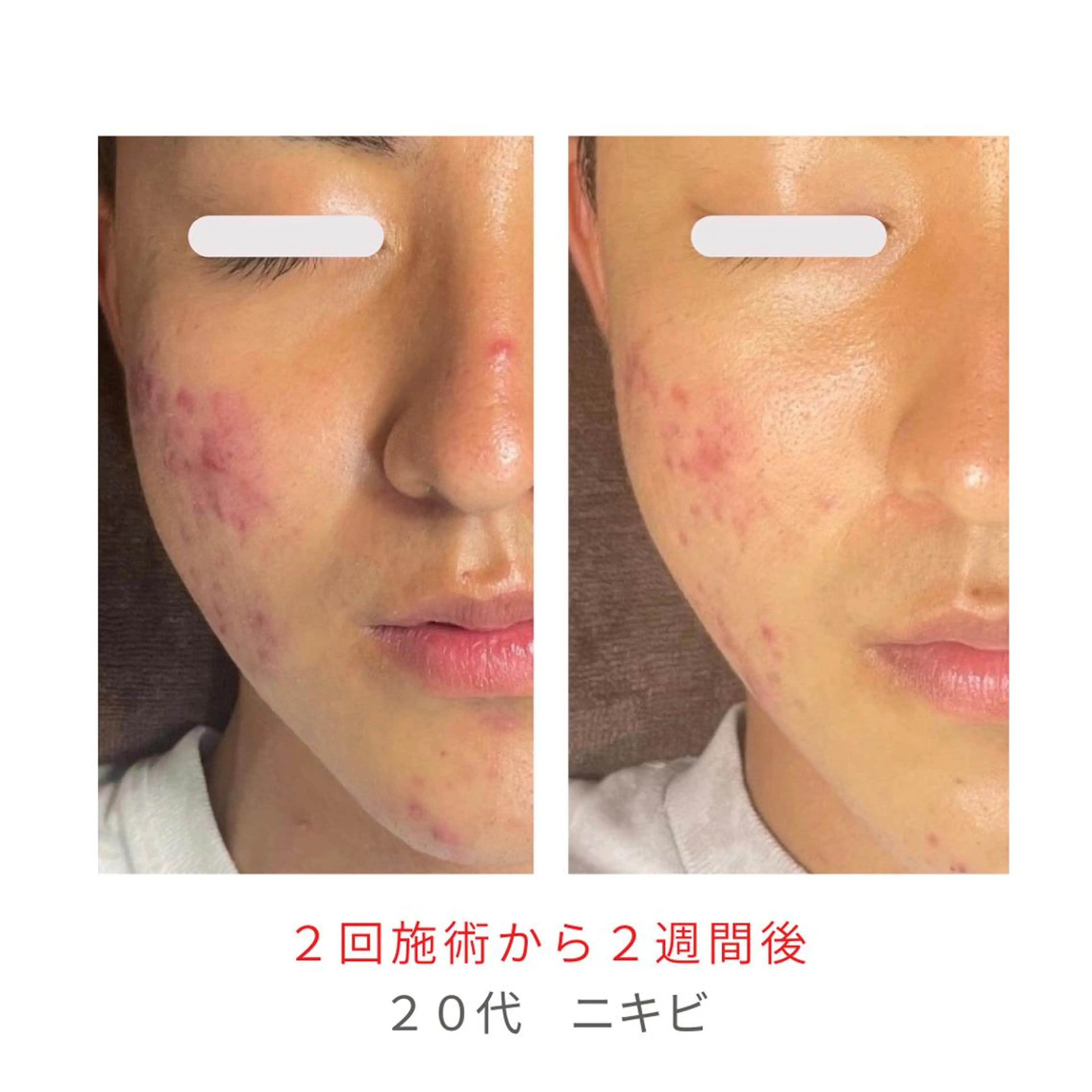 ベラージュ【美背中・ 美尻・フェイシャル】のエステ・リラクイメージ