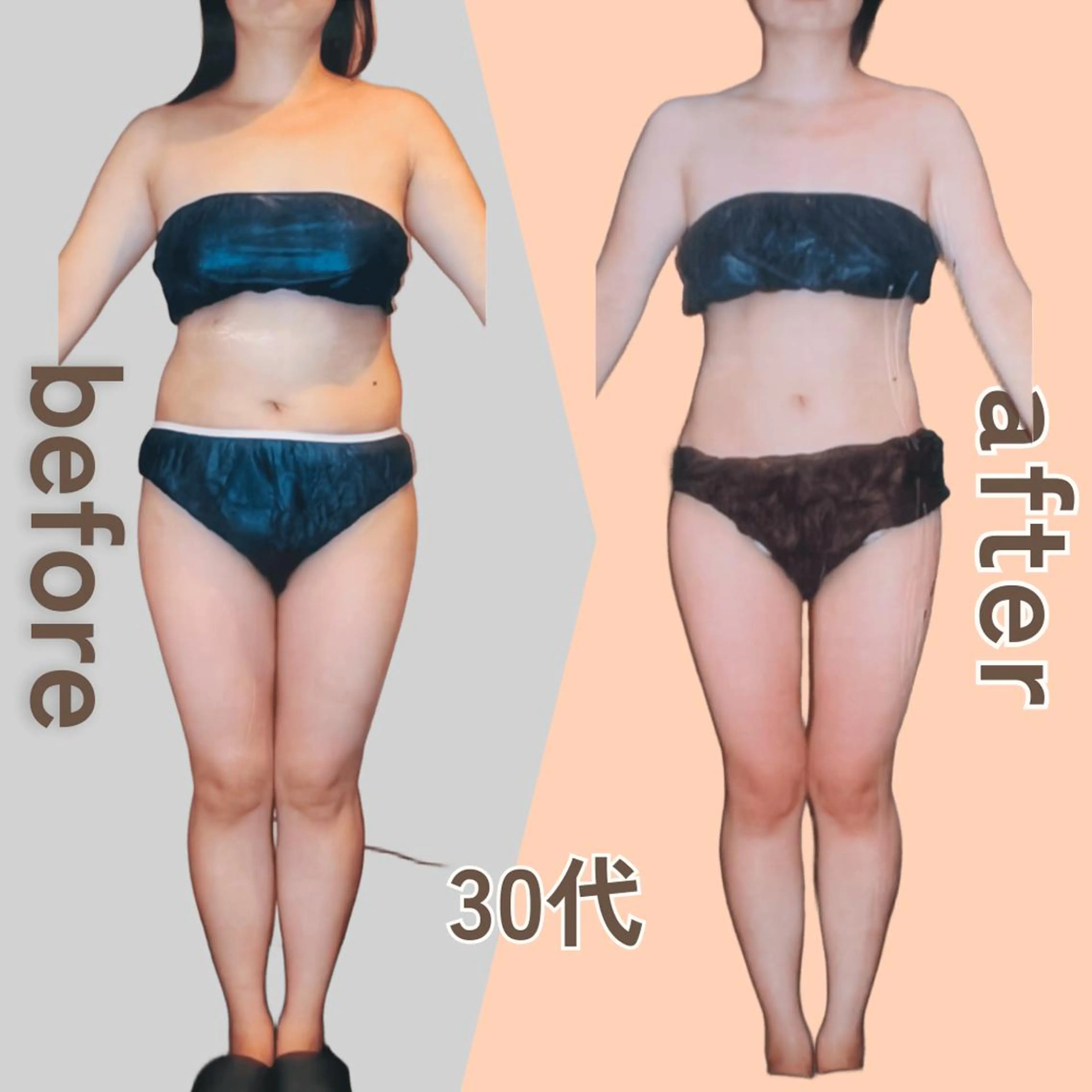 痩身エステ Julien麹町店のエステ・リラクイメージ