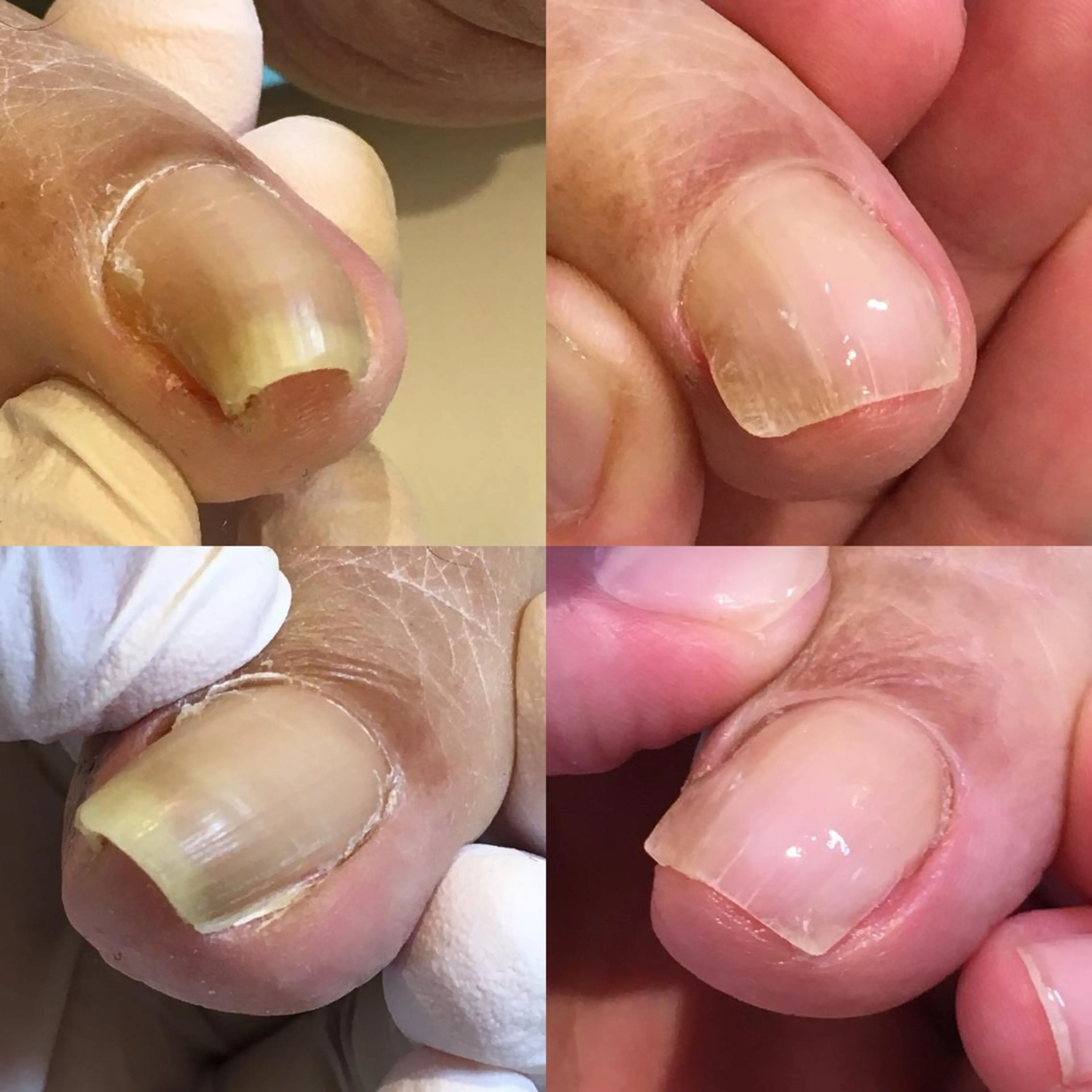 ネイル 東京巻き爪アカデミー所属・東京巻き爪 アカデミーのエステ・リラクイメージ