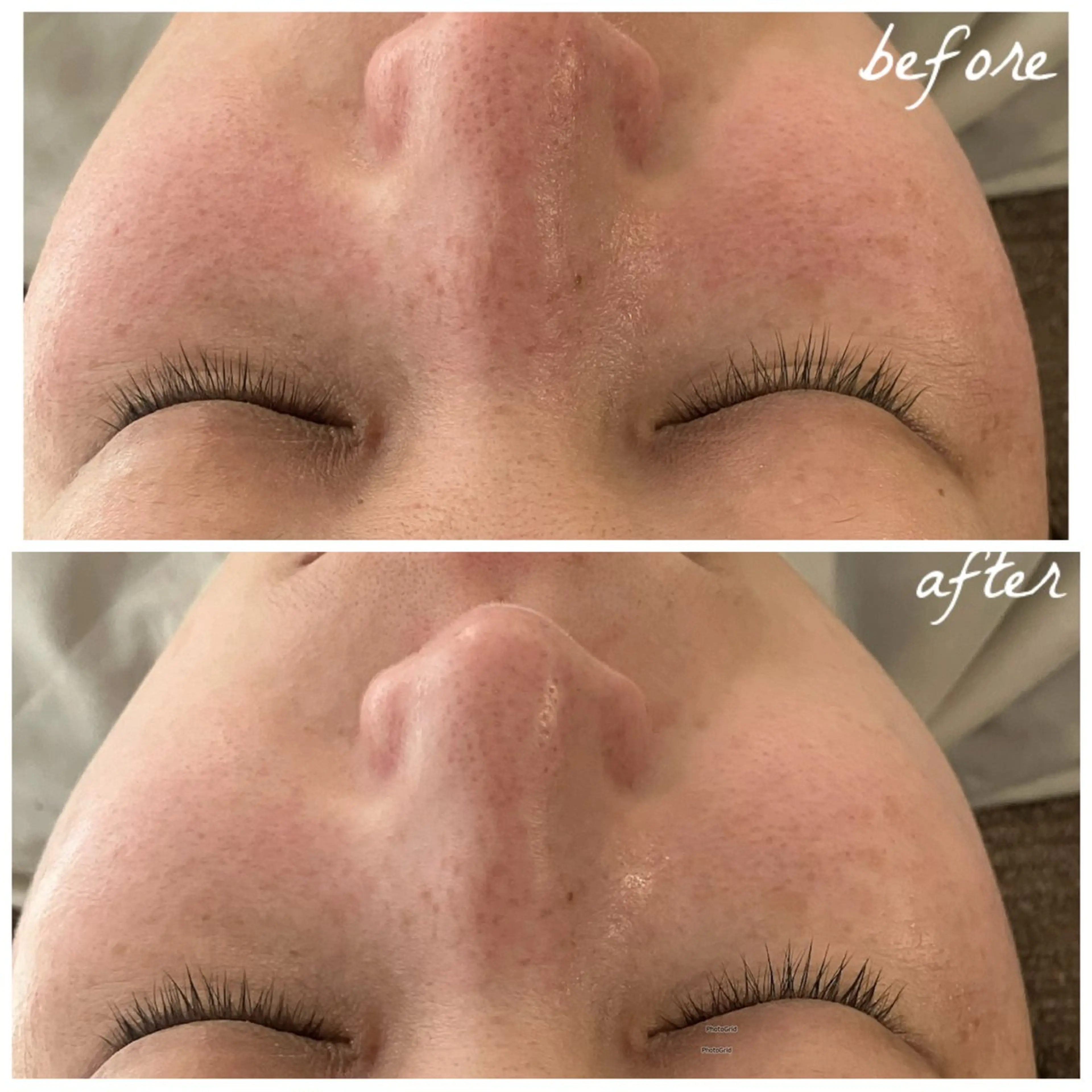 メンズ エステ メナード岐阜茜部 杉浦のエステ・リラクイメージ