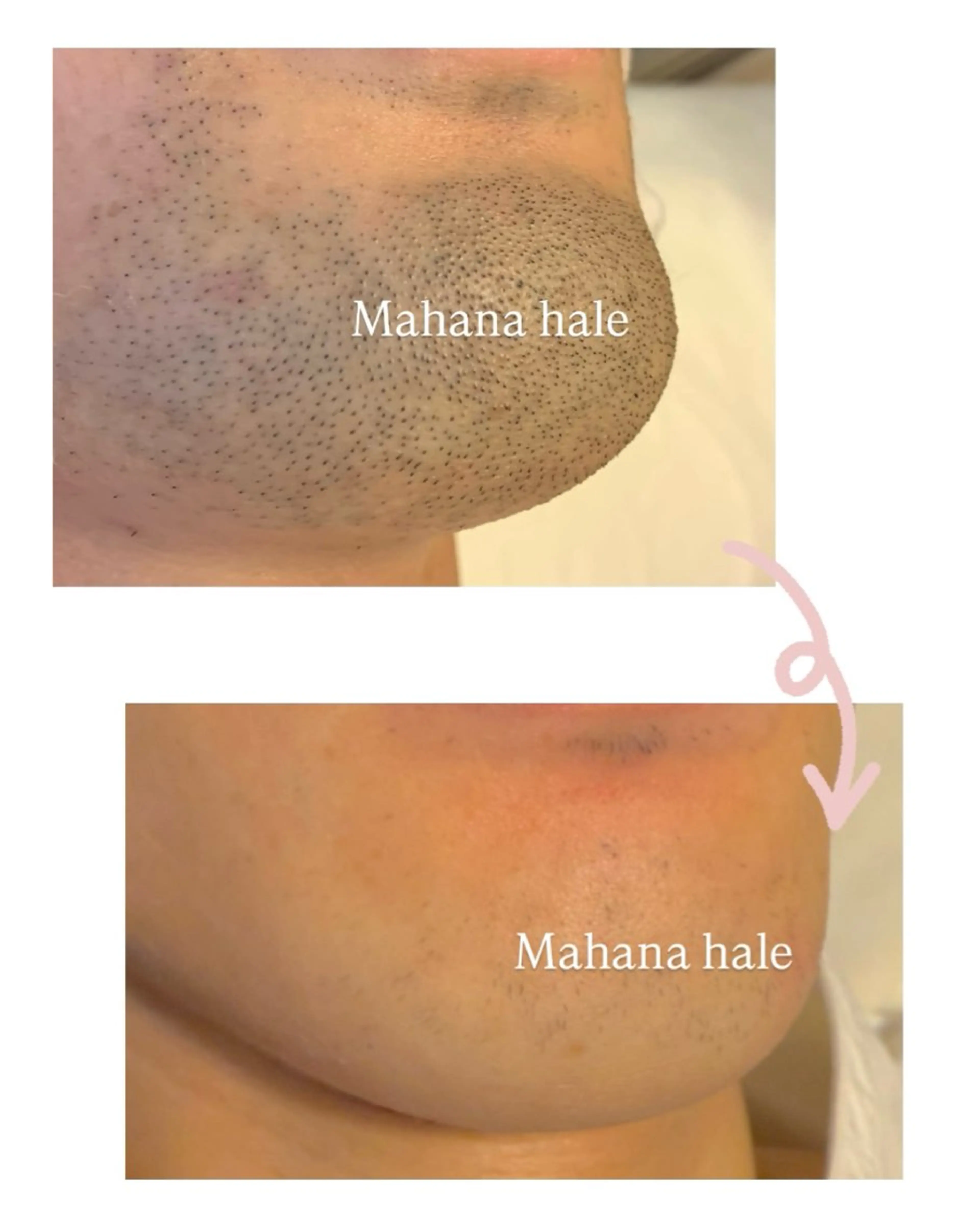 Mahana hale所属・Mahana haleのエステ・リラクイメージ