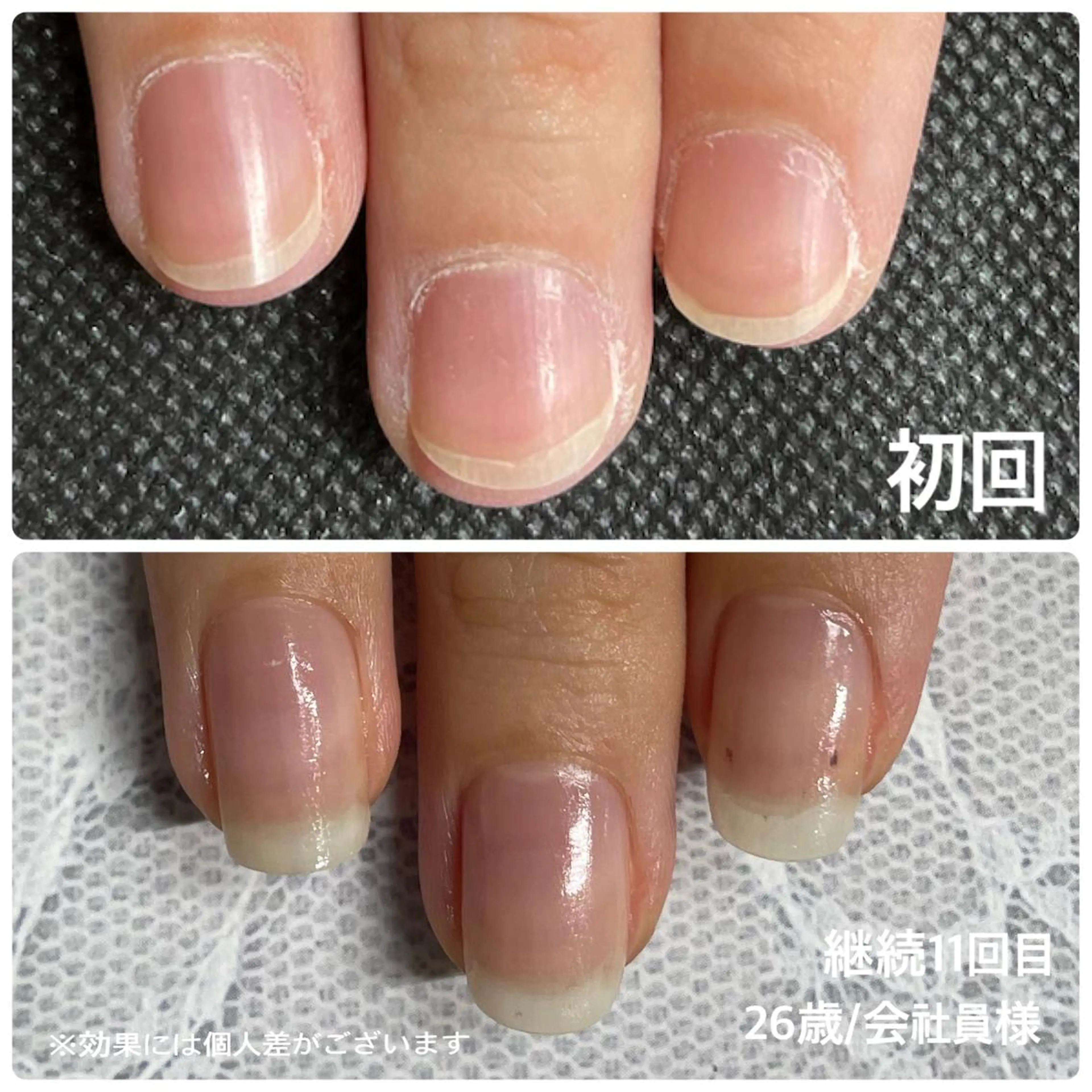 ネイル 奥園 良恵のネイルデザイン