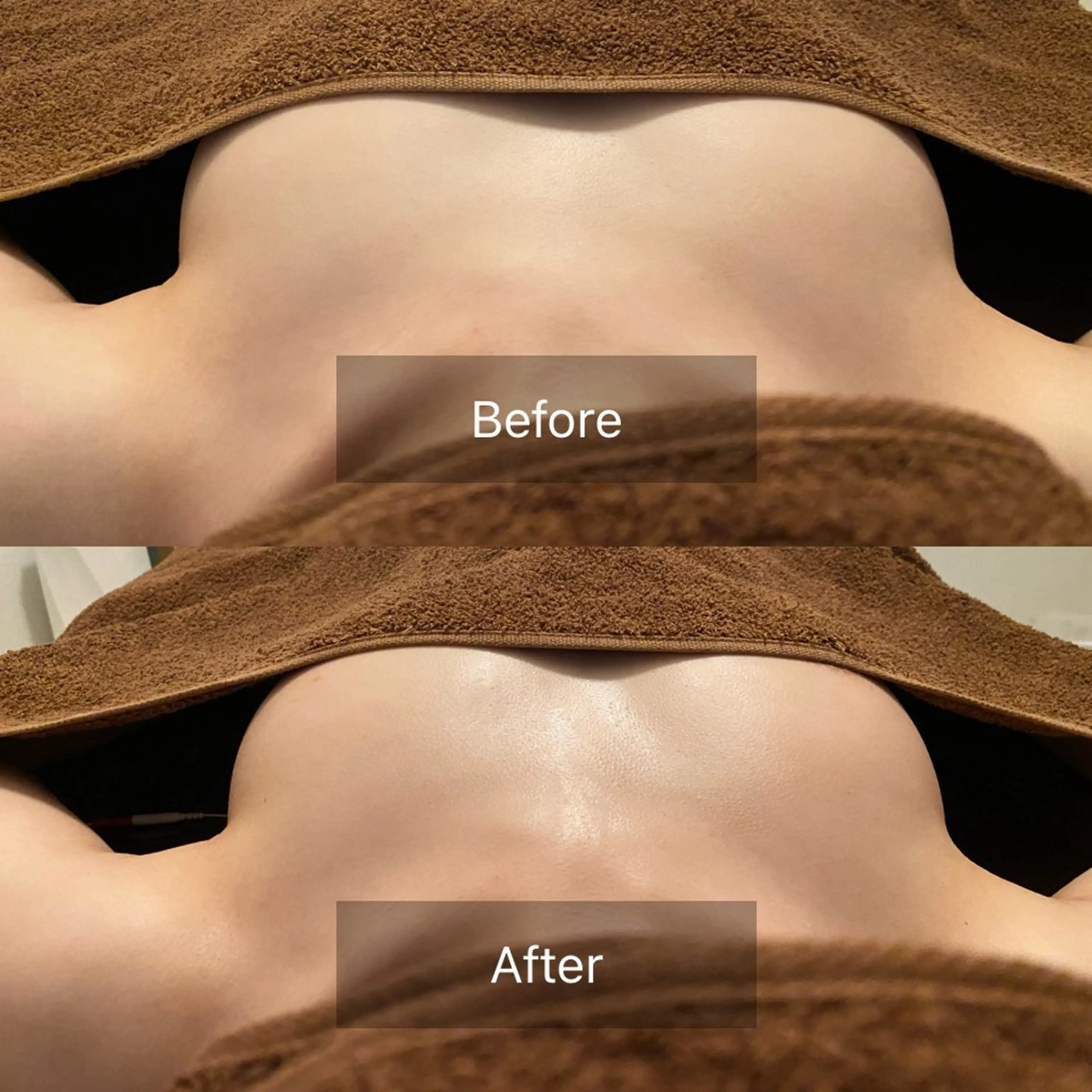 人気No. 1🌟クリスマスに向けて🎄たった一度でボリュームUP・ハリ・弾力・下垂・左右差改善!! ふわふわバストケアの写真