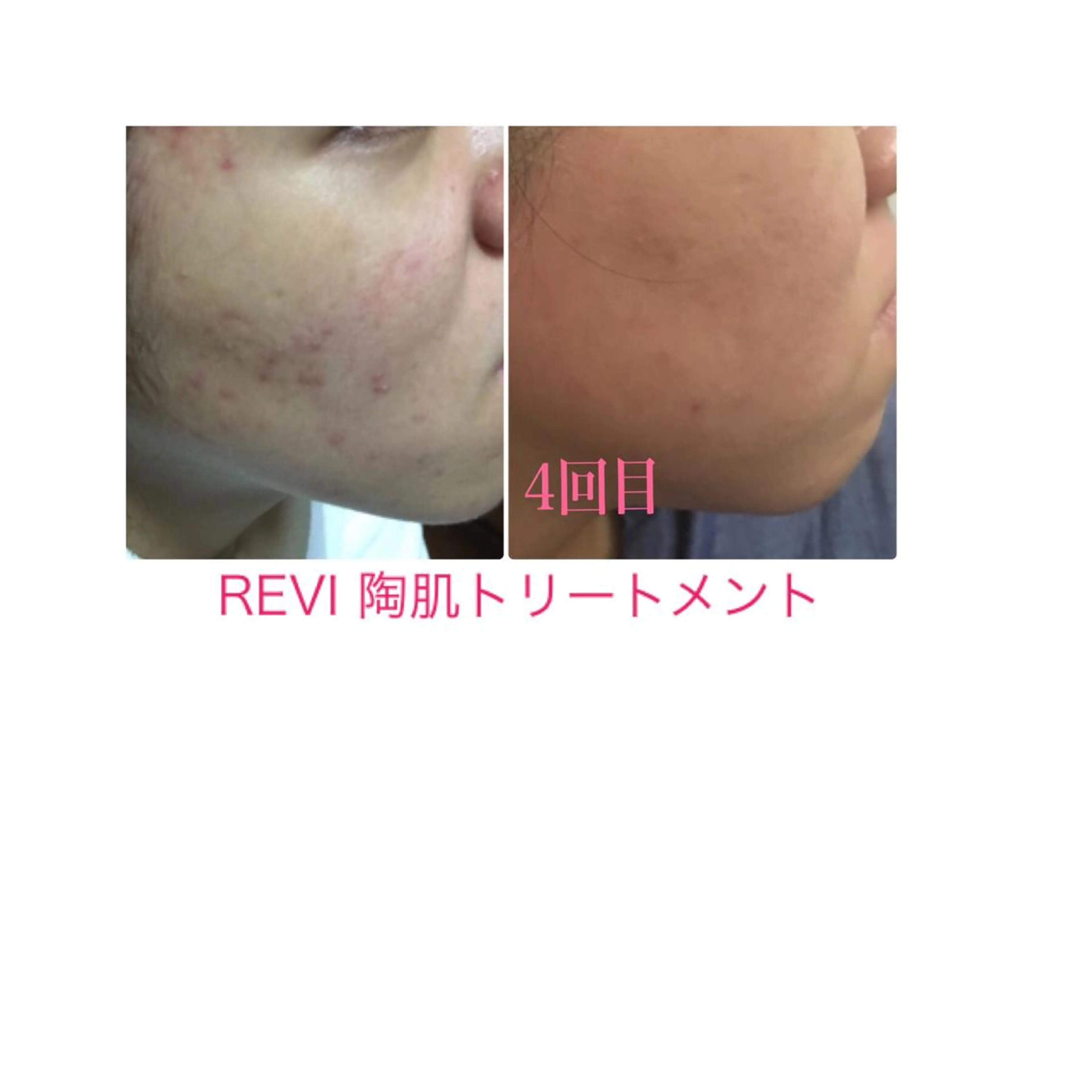 痩身専門サロン ビューティーグランツのエステ・リラクイメージ