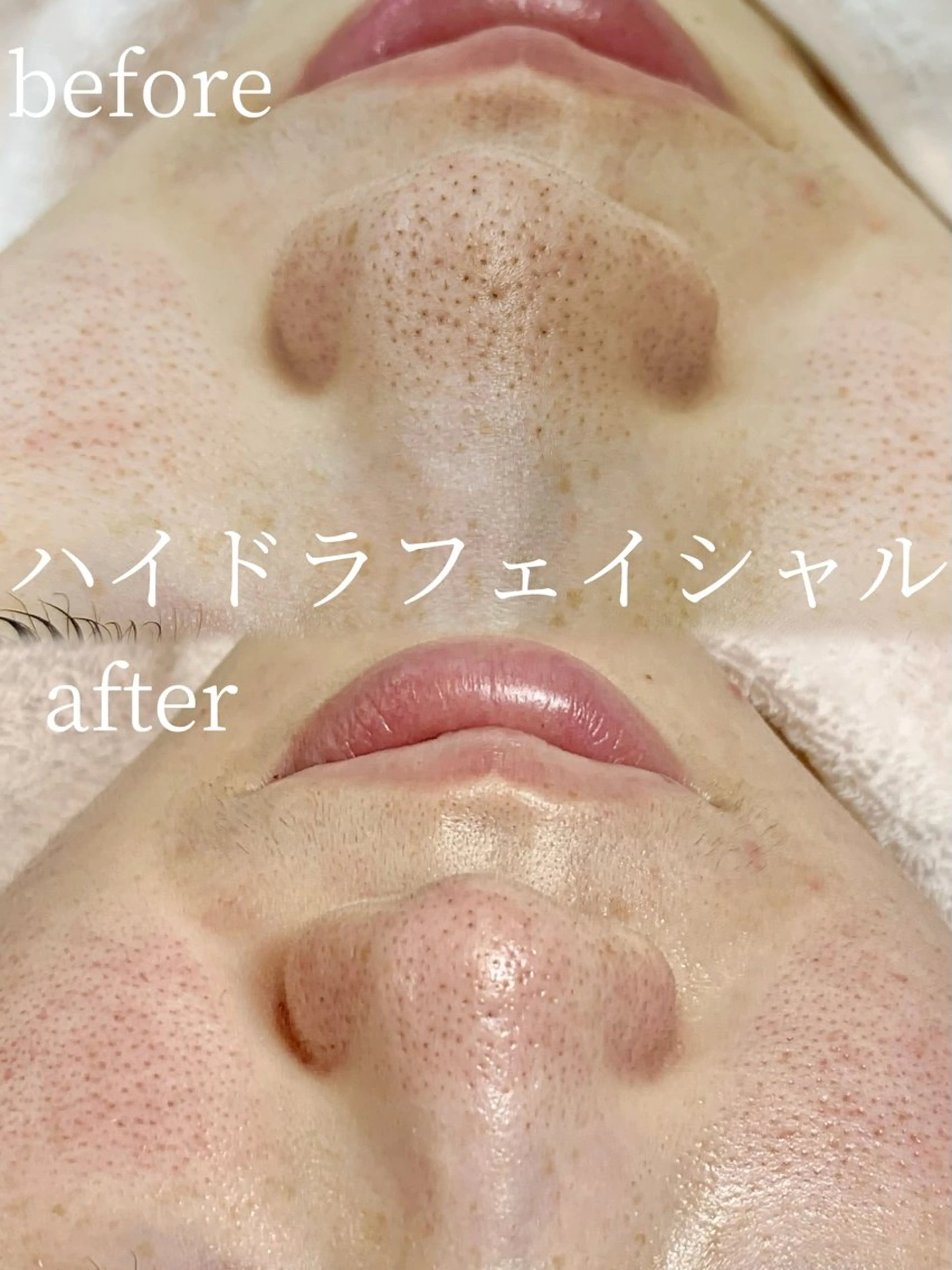 エステ リラク lifra CHISAのマツエク・マツパデザイン