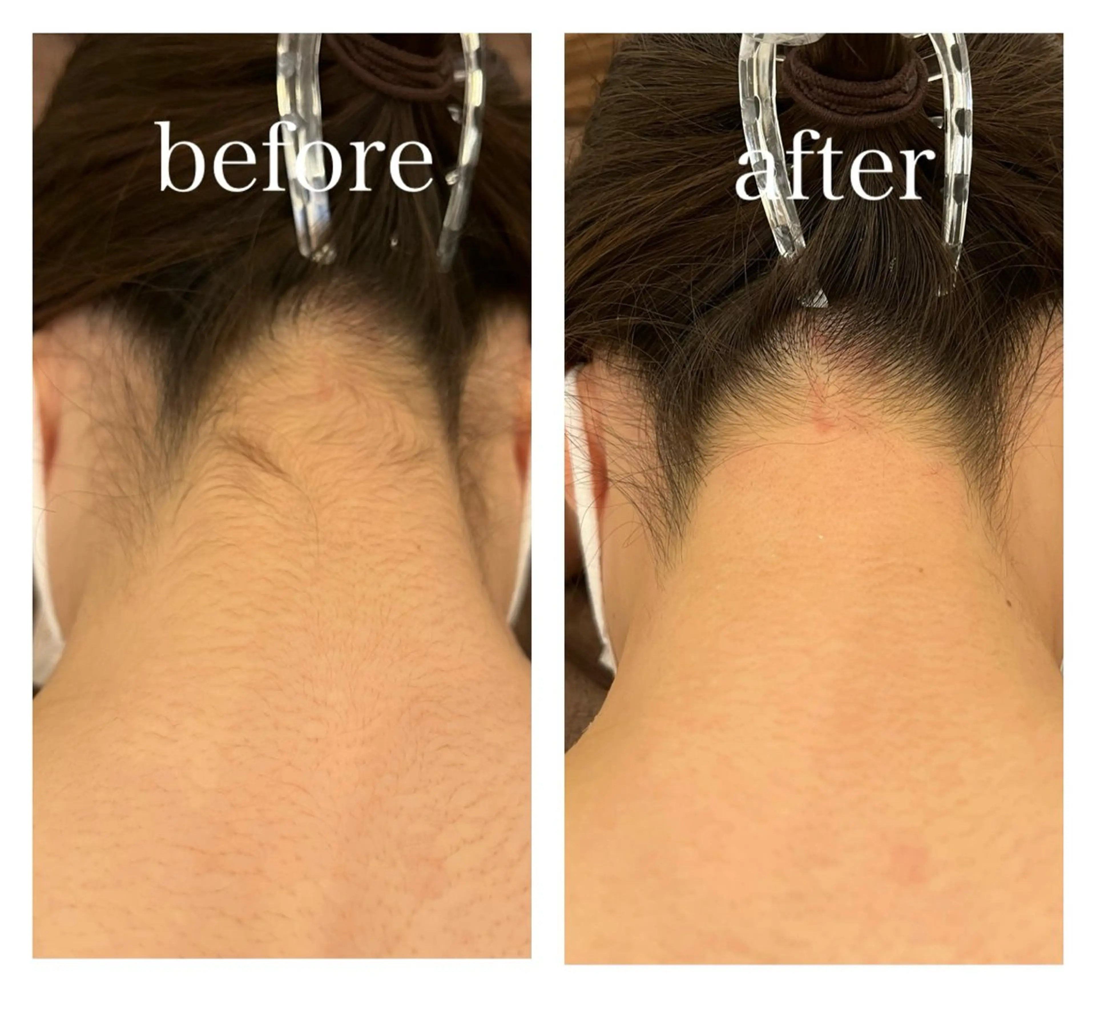 Elenear神戸元町所属・フェムケアサロン神戸 Elenear　なつのエステ・リラクイメージ