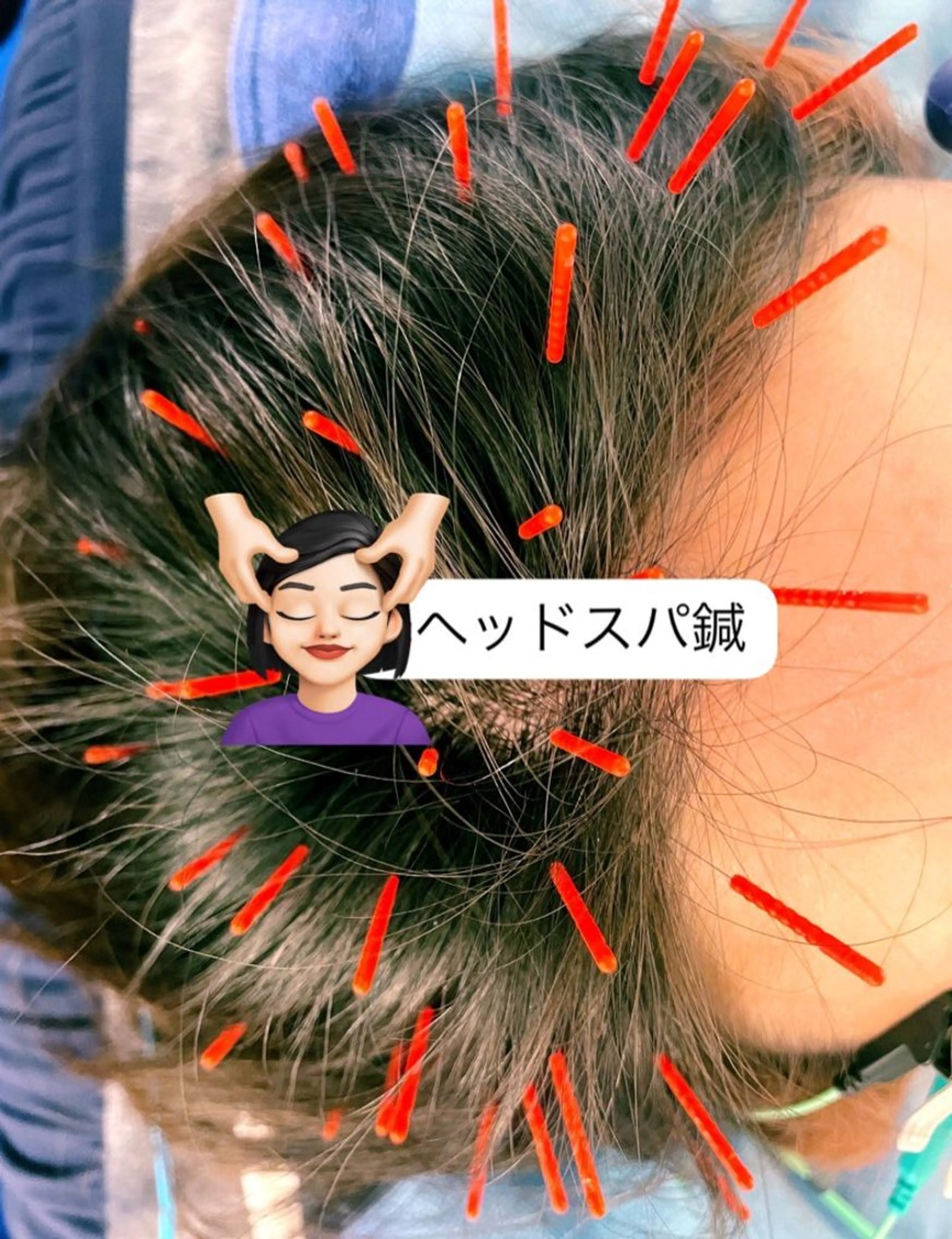 小顔美容鍼専門サロン 渋谷YZのエステ・リラクイメージ