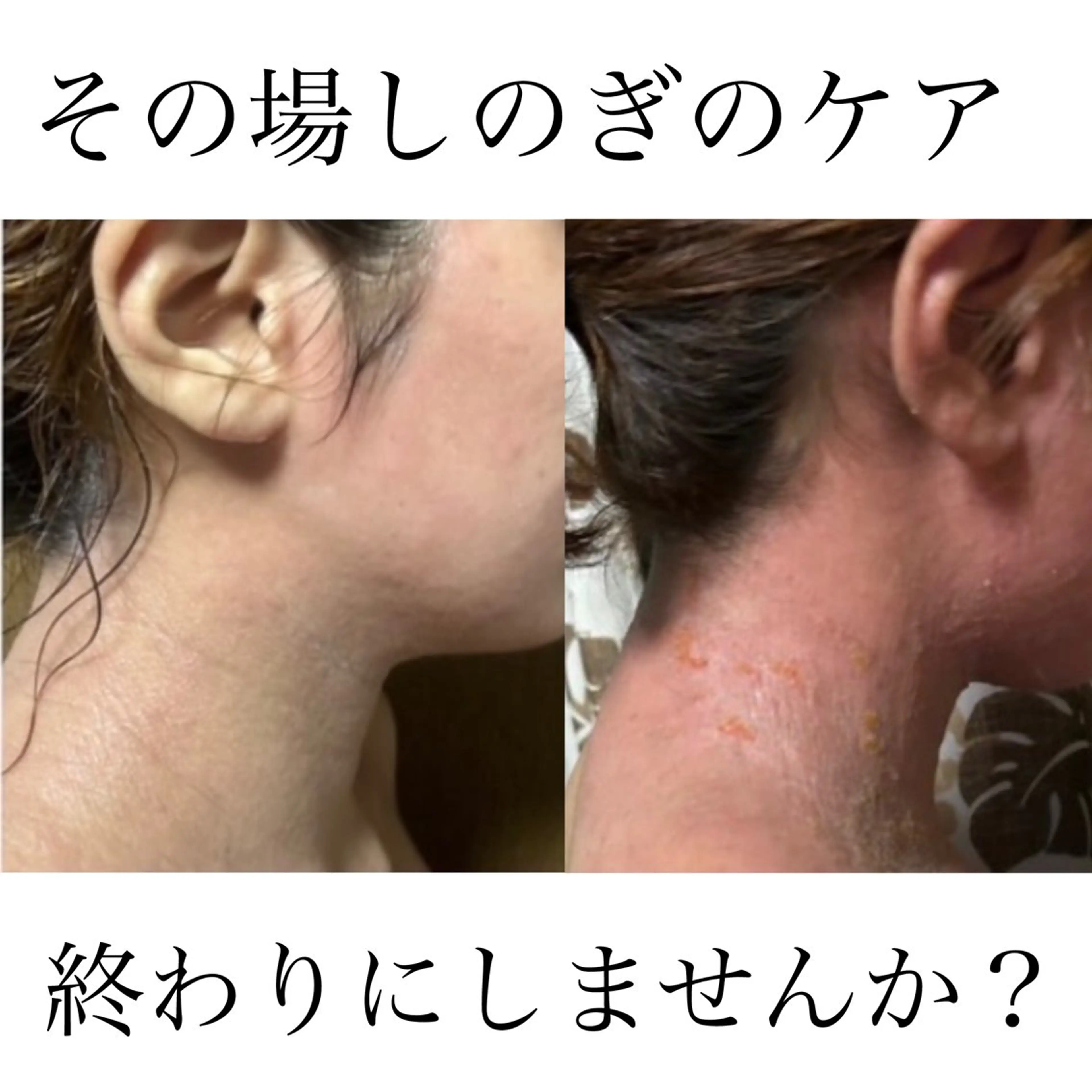 salon  OAK所属・痩身/肌改善/脱毛 /リラク/MoaNaのエステ・リラクイメージ