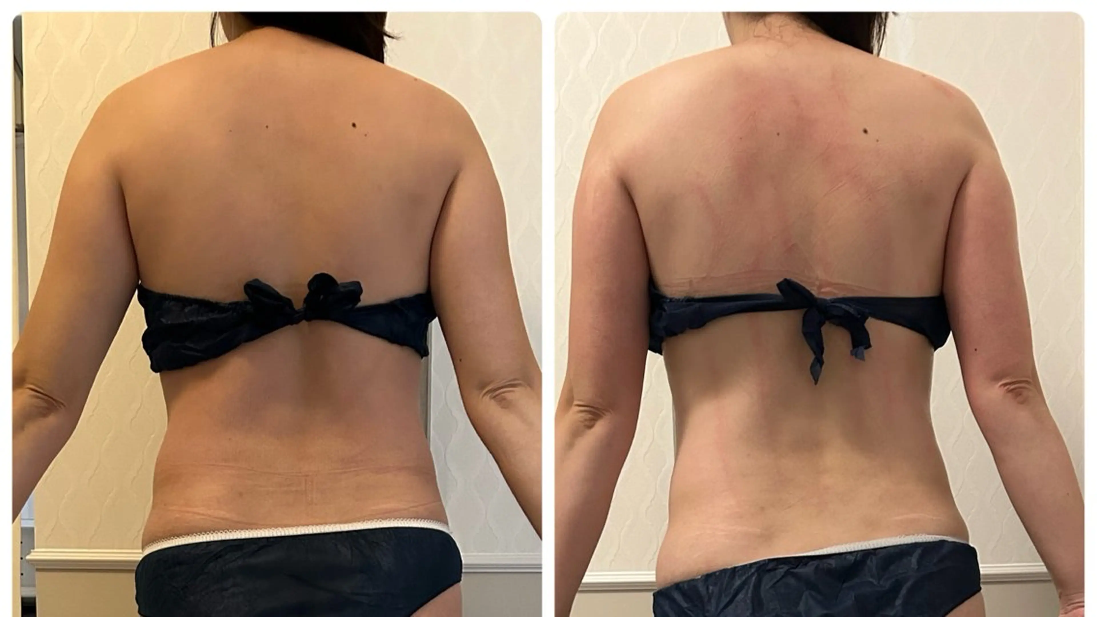 【強力リンパ】痩身デトックスマッサージで血流UP♪ 80分¥12000→¥9200の写真