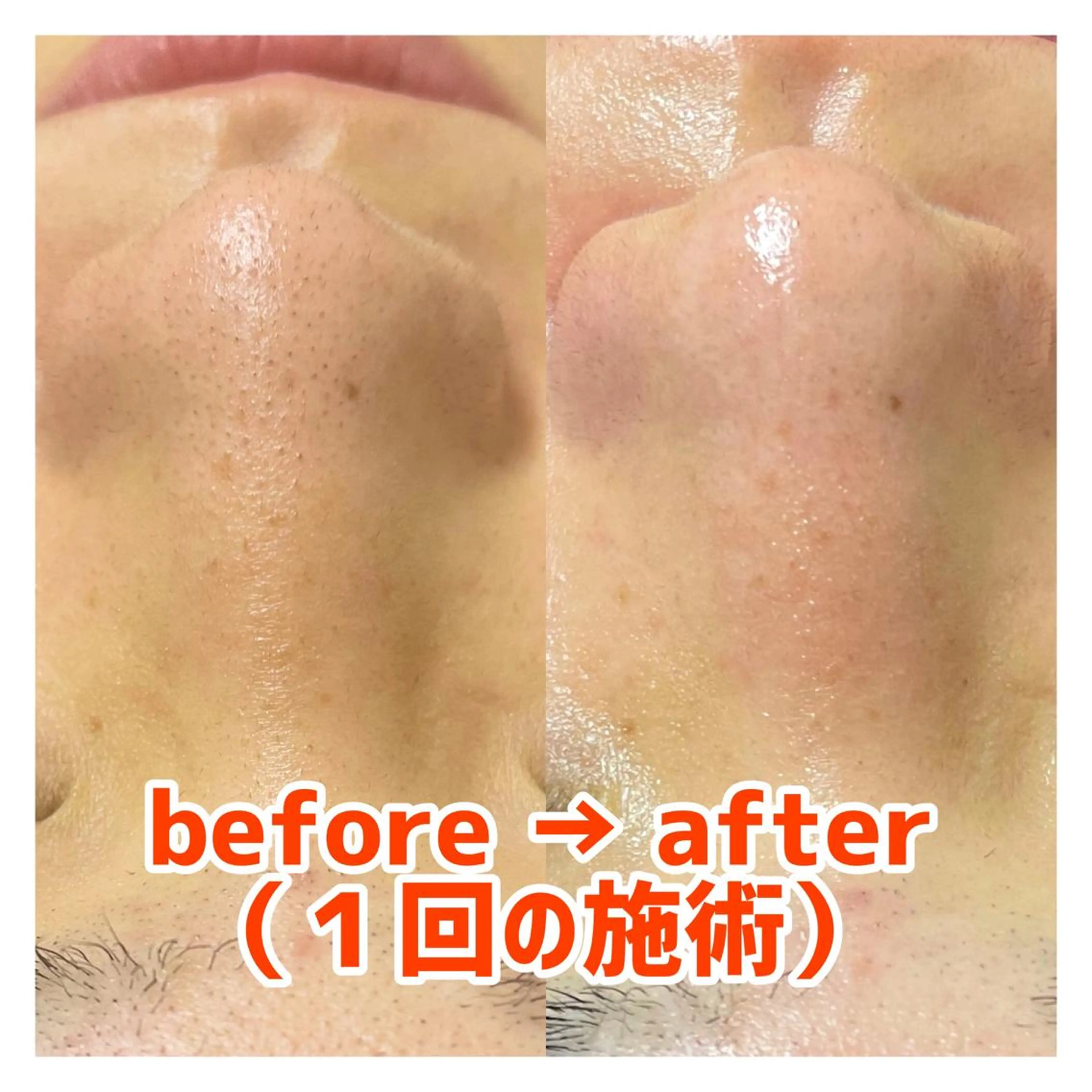 エステ 〜小顔・痩身・リラクゼーション〜　　Y&o Esthetic  Salon所属・HANA MIKIの眉毛・アイブロウイメージ