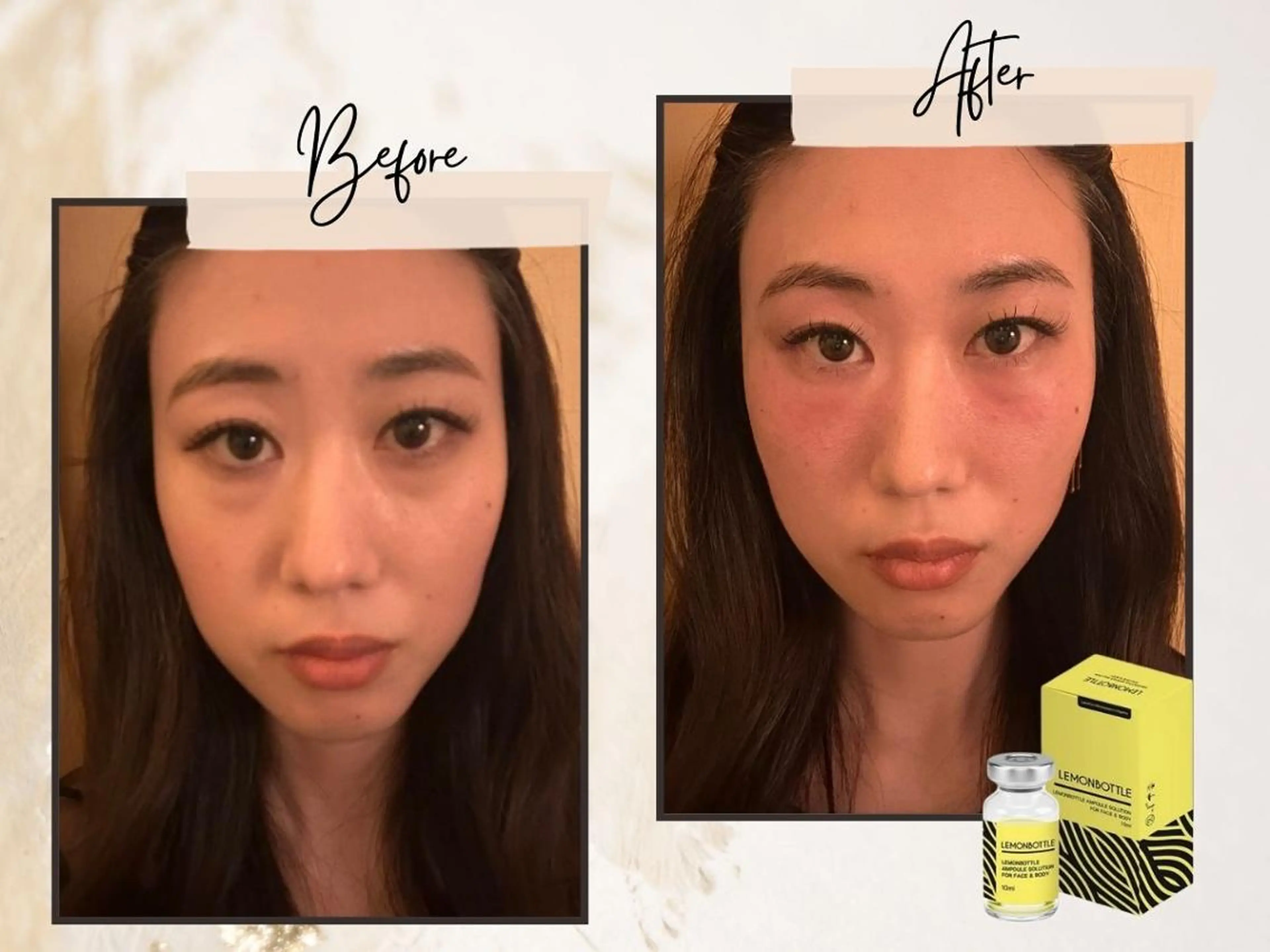 ララピール銀座 小顔フェイシャルのエステ・リラクイメージ