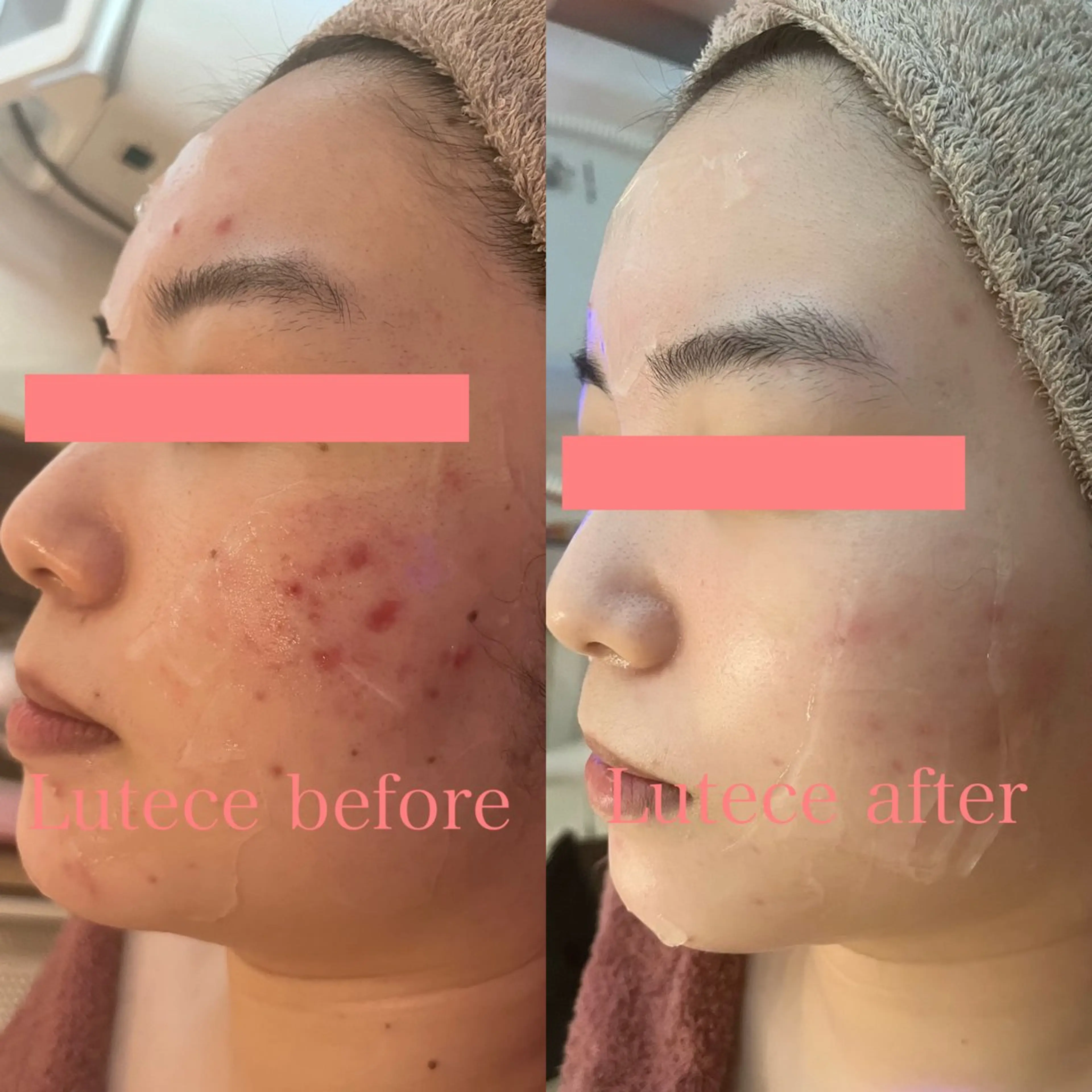 エステ 池田 麻美子のエステ・リラクイメージ