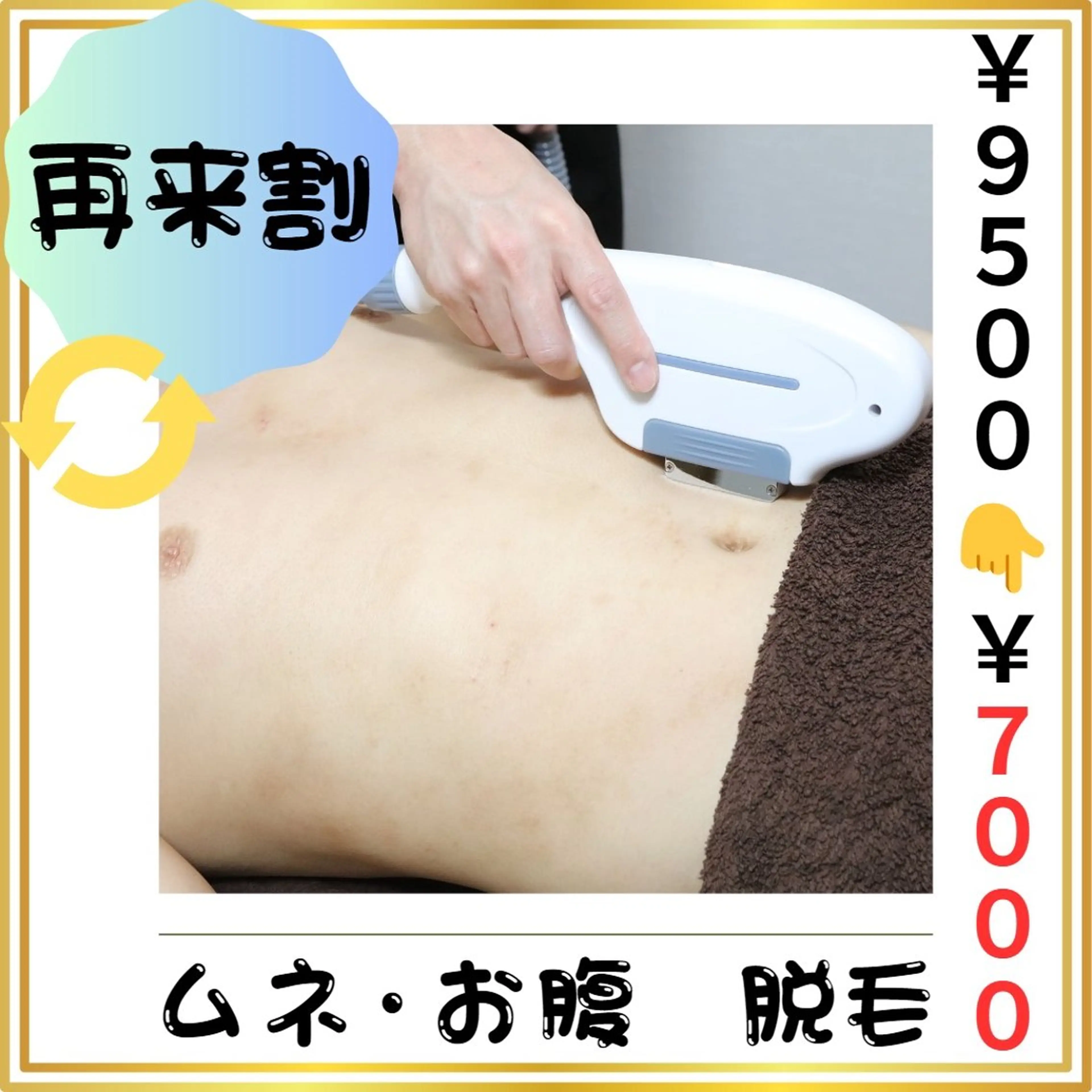 🔄再来割🔄【胸周り・お腹 脱毛】 (#メンズ脱毛　#清潔感UP　#女性ウケUP  #都度払い)の写真