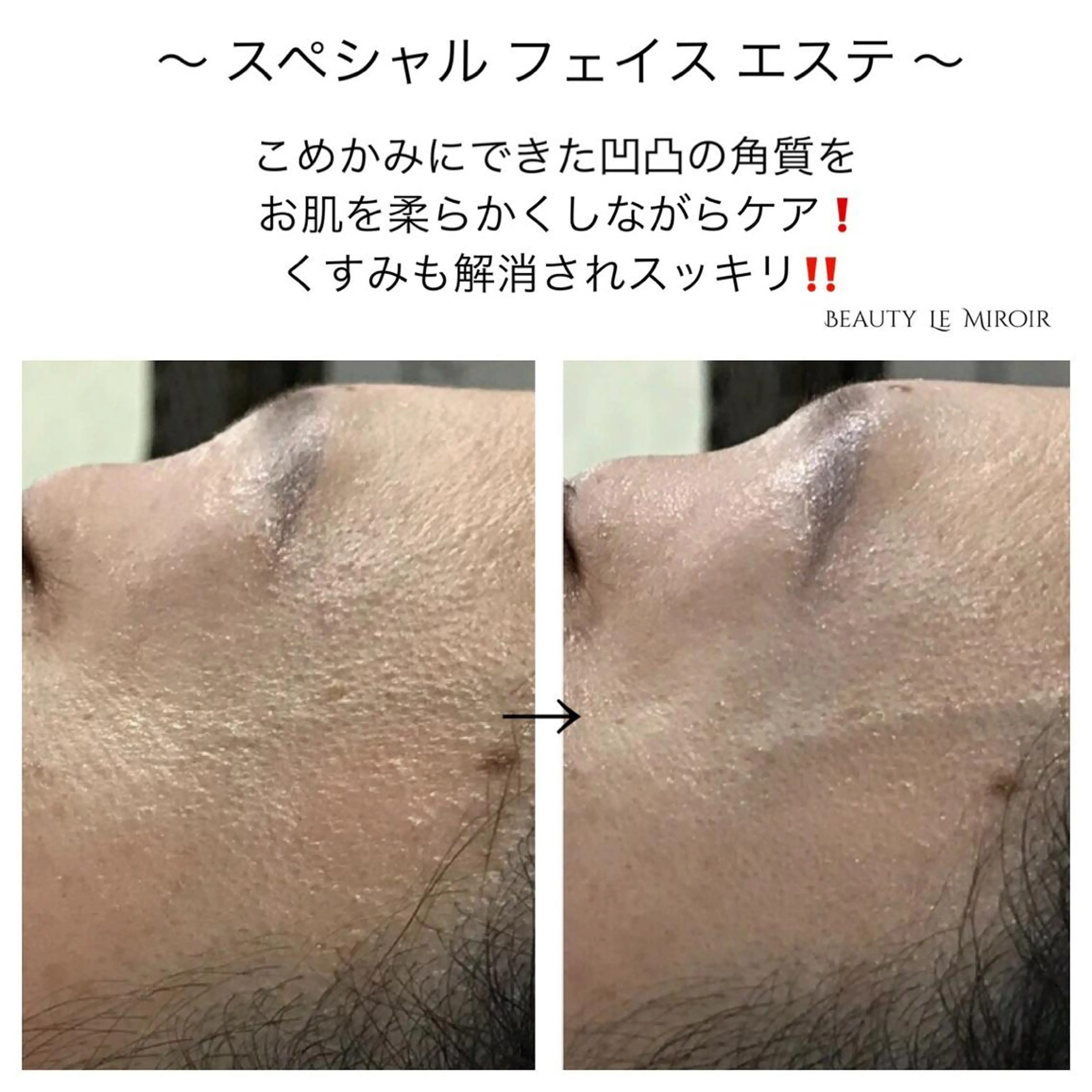 ビューティー ミロワールのエステ・リラクイメージ