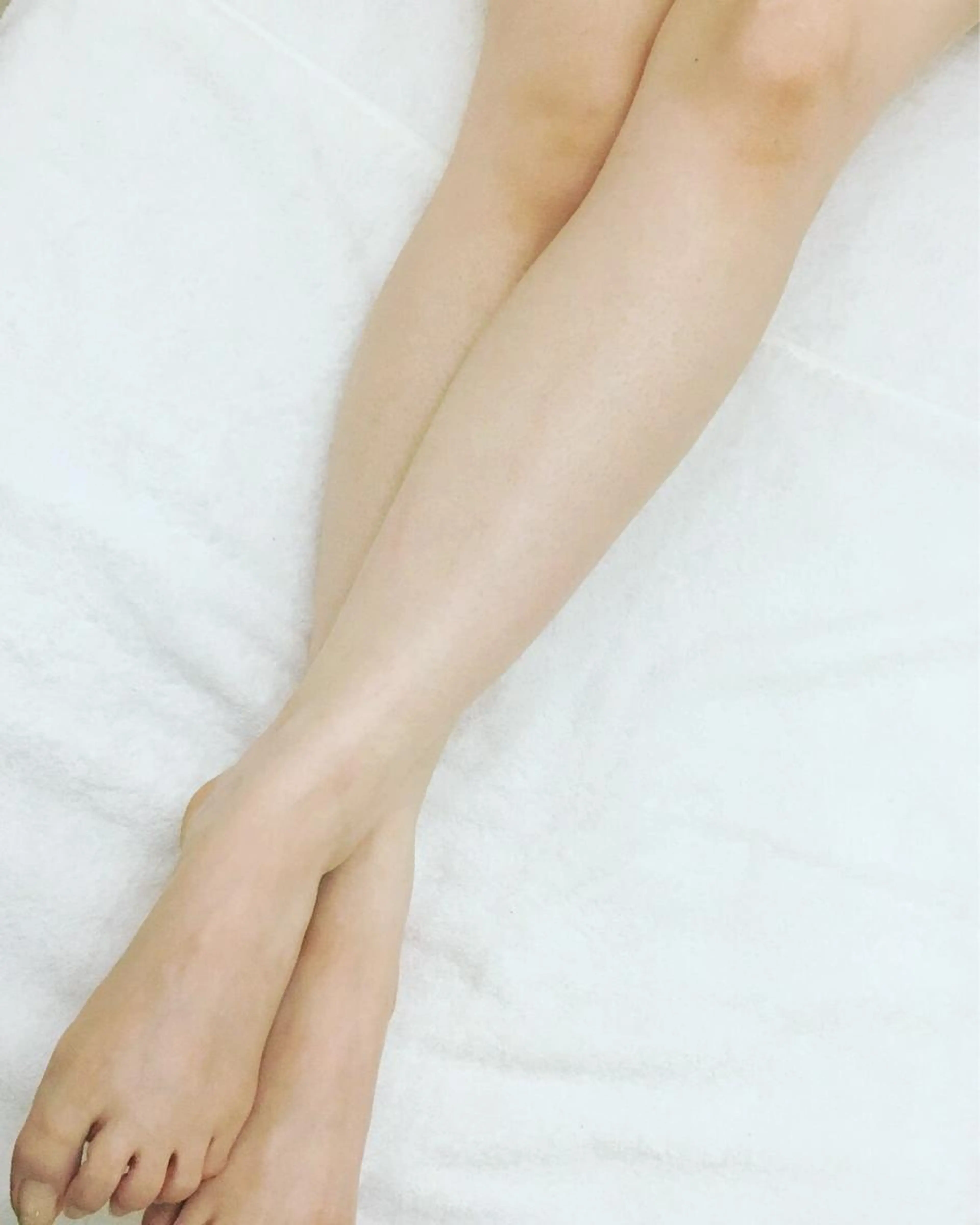 むくみすっきり脚やせエステ//ハイパーナイフ＆アロママッサージの写真