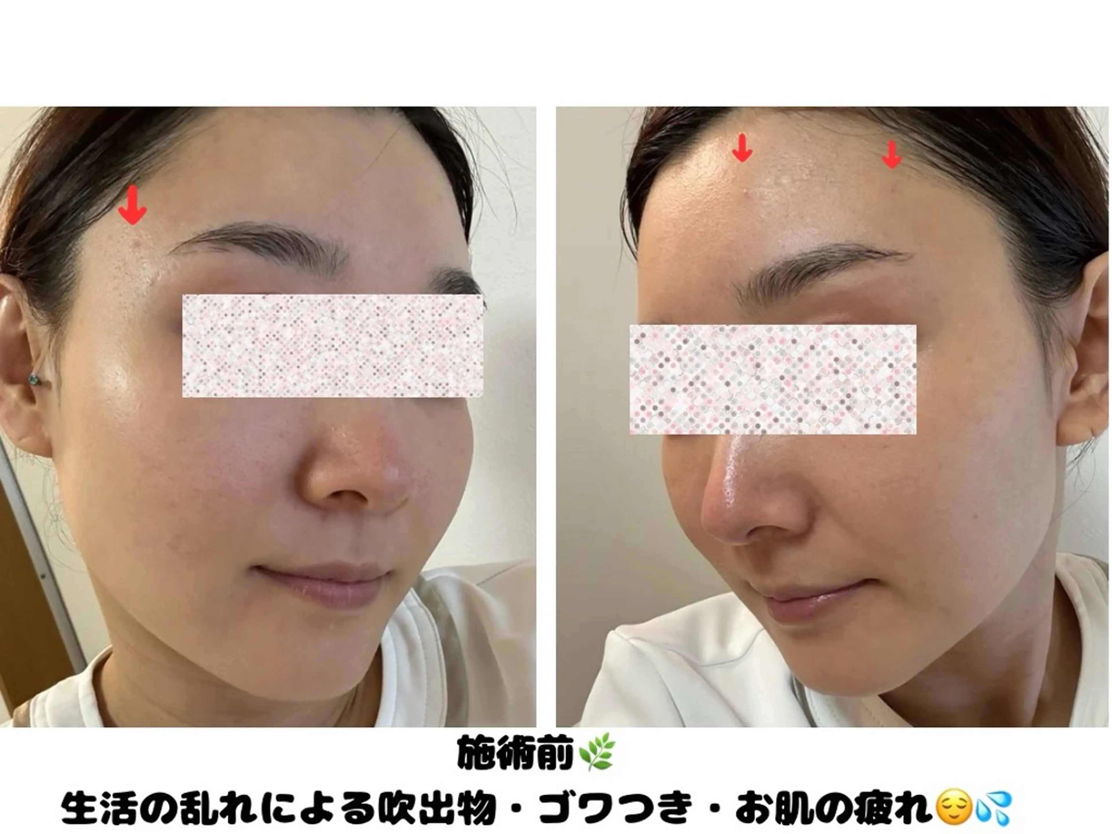 VIKI BEAUTY  クレイハーブピーリング・美肌脱毛専門店所属・VIKI BEAUTYのエステ・リラクイメージ