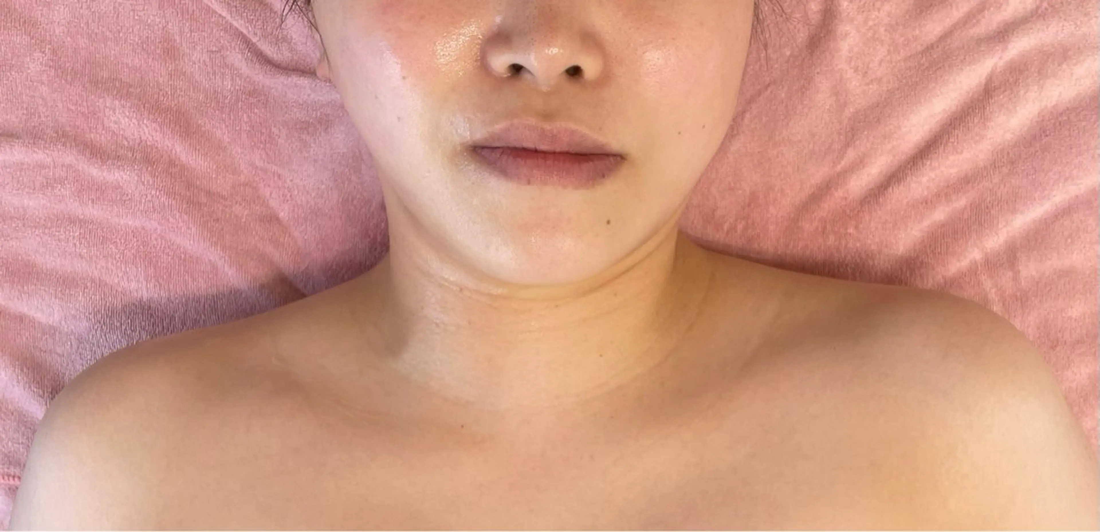 【ツヤ肌･リフトアップ】ララピール+筋膜EMSの写真