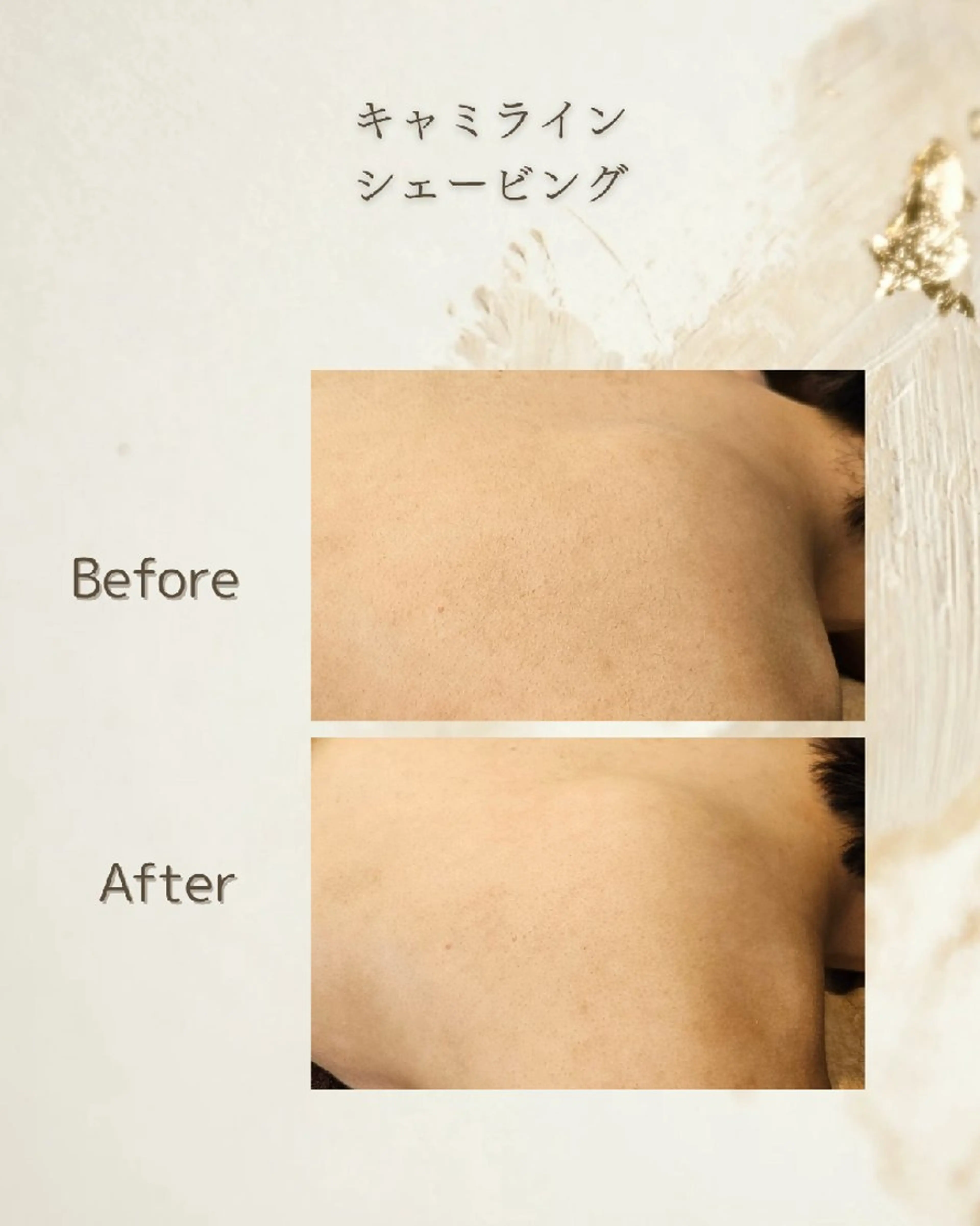 【背中と二の腕】オフショルライン&アームシェービングの写真