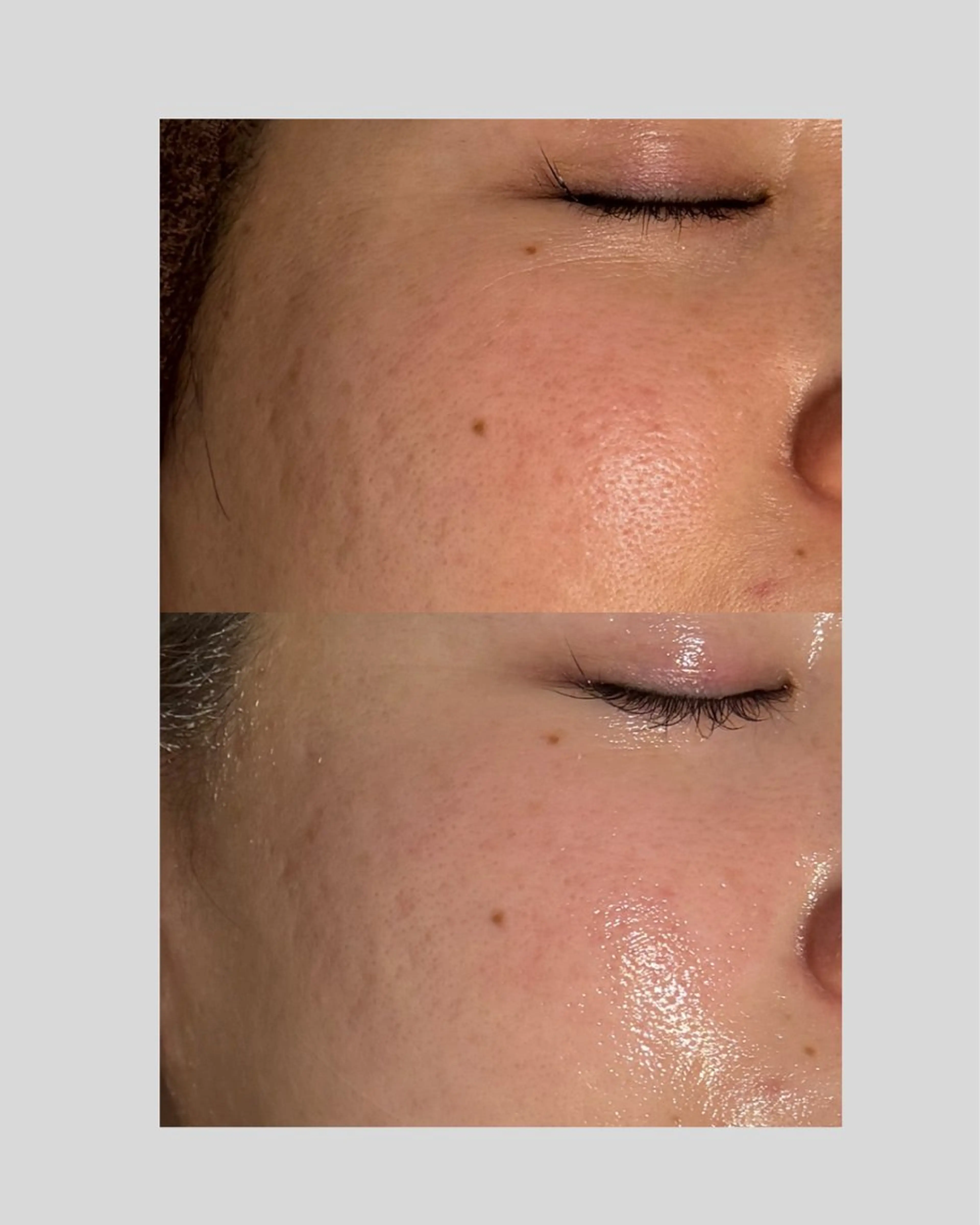 肌管理フェイシャル|Utouto所属・肌管理フェイシャル Utoutoのエステ・リラクイメージ