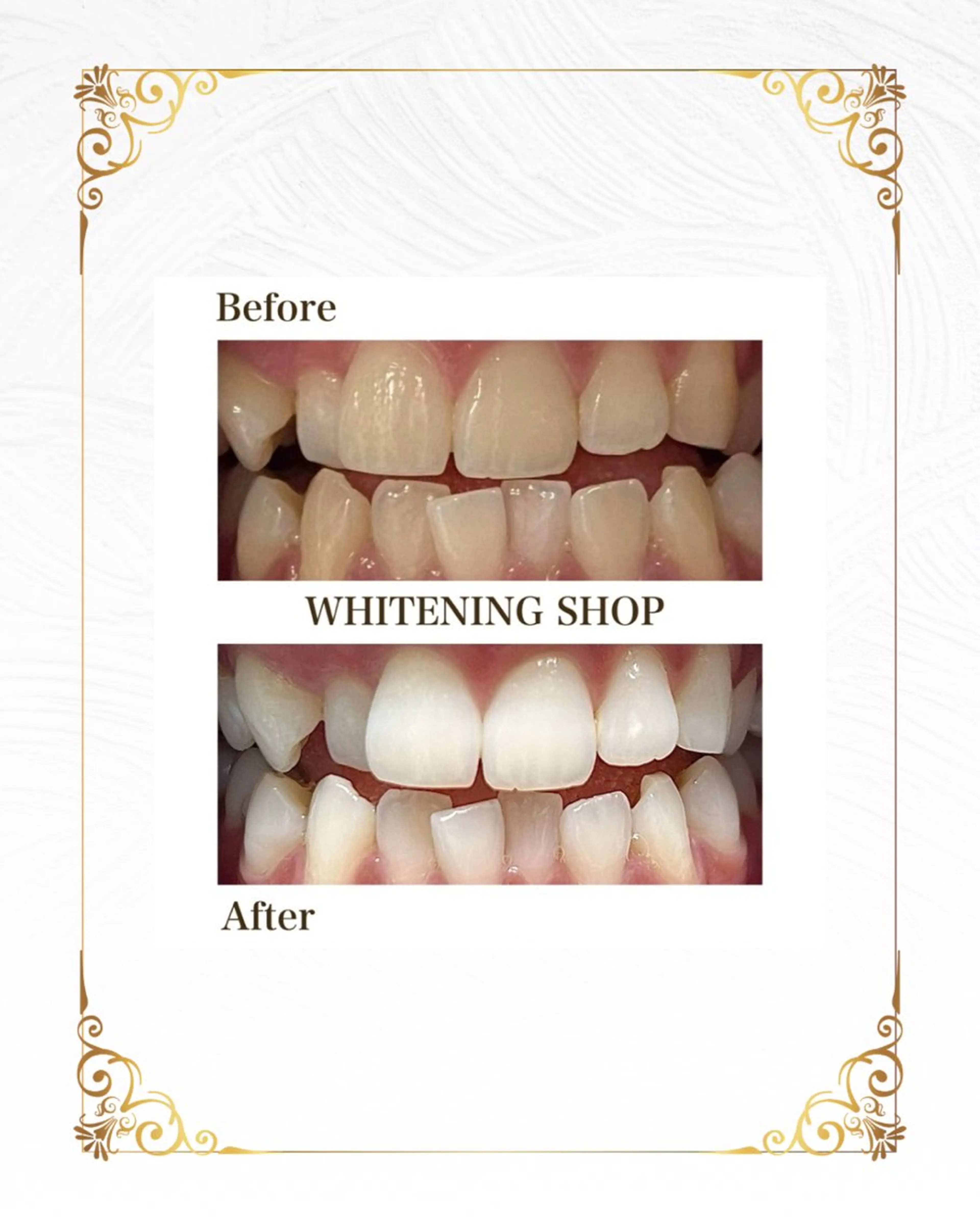 ホワイトニングショップ静岡葵区店所属・ホワイトニング ショップ葵区静岡駅店のその他イメージ