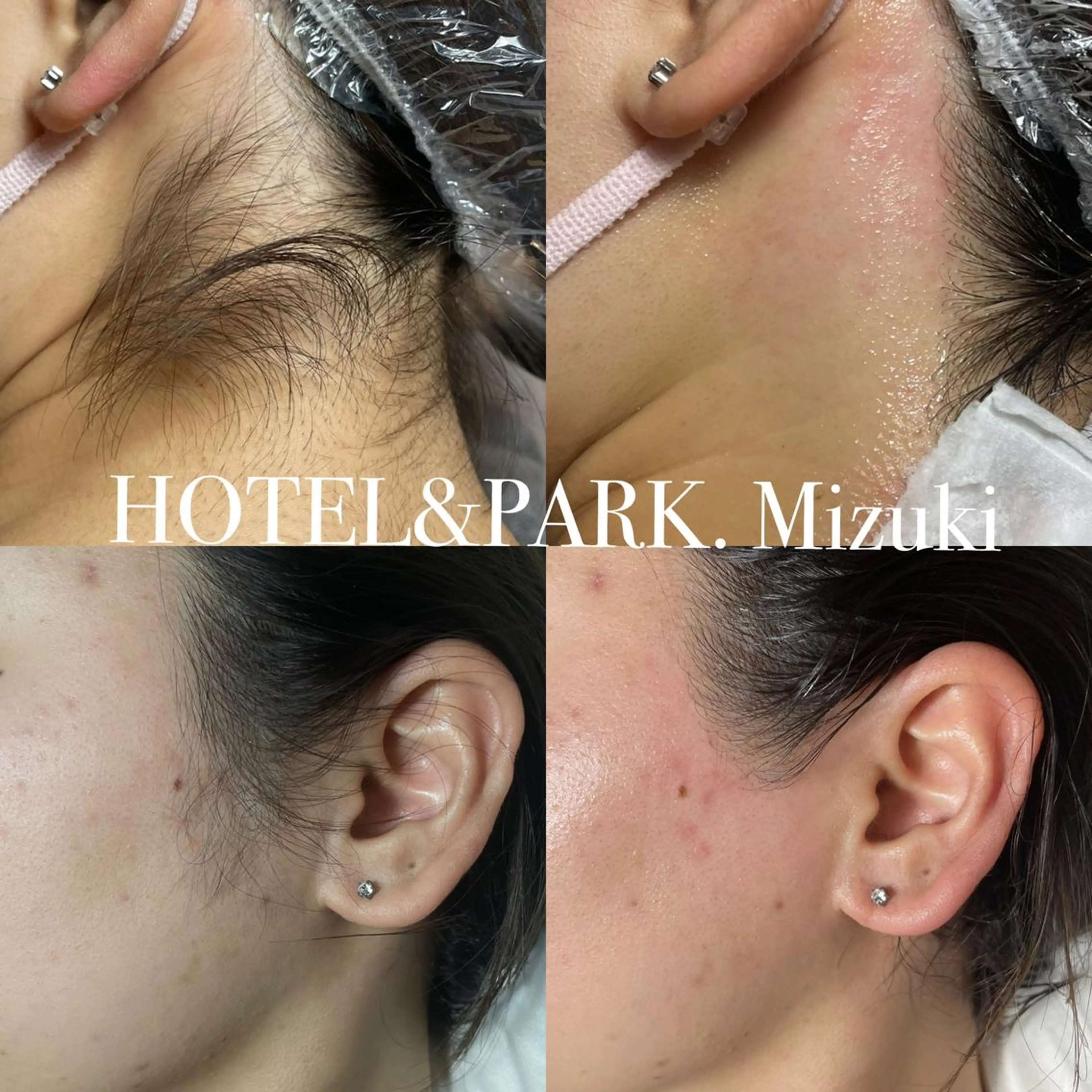 HOTEL&PARK . ワックス脱毛のエステ・リラクイメージ