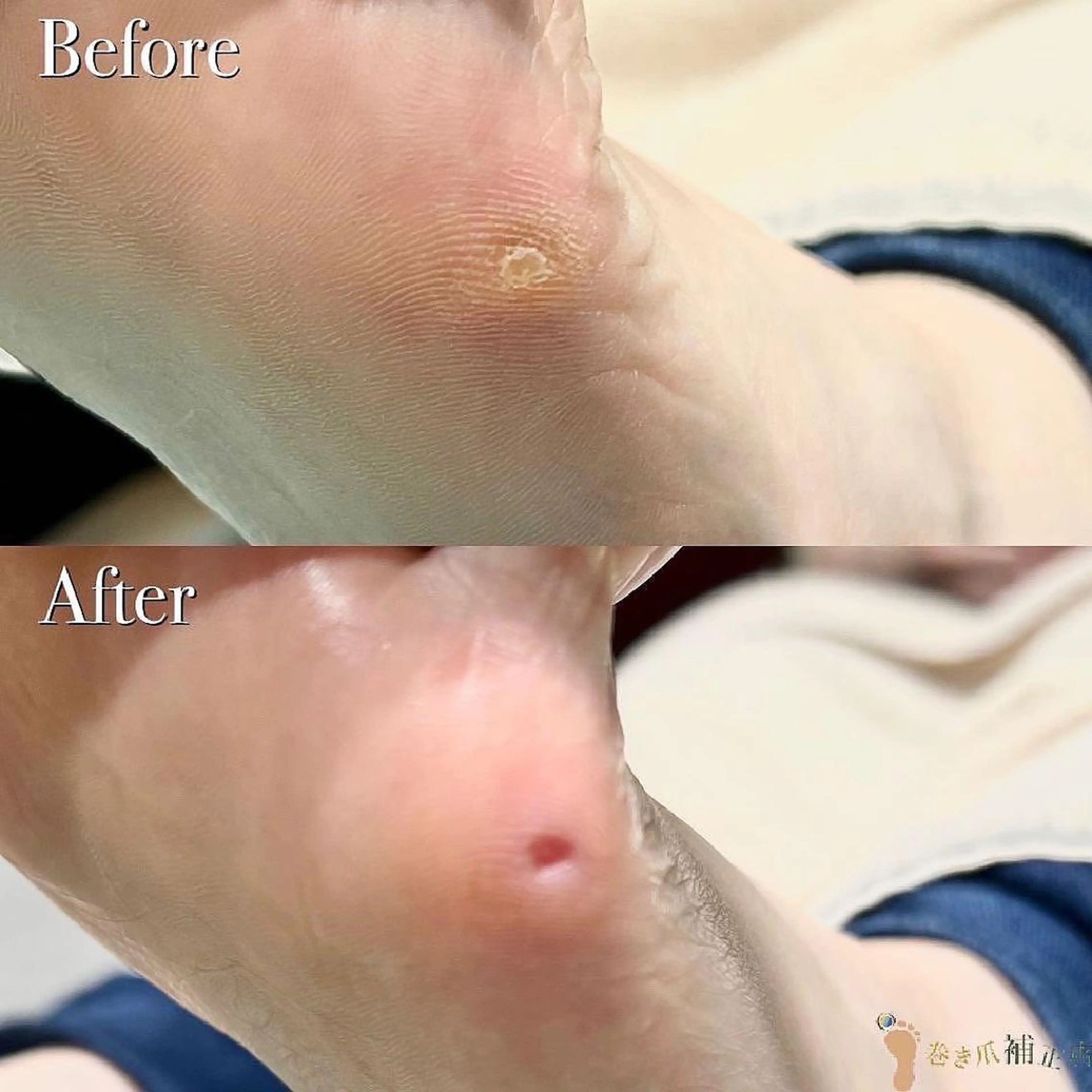 東京巻き爪アカデミー所属・東京巻き爪 アカデミーのエステ・リラクイメージ