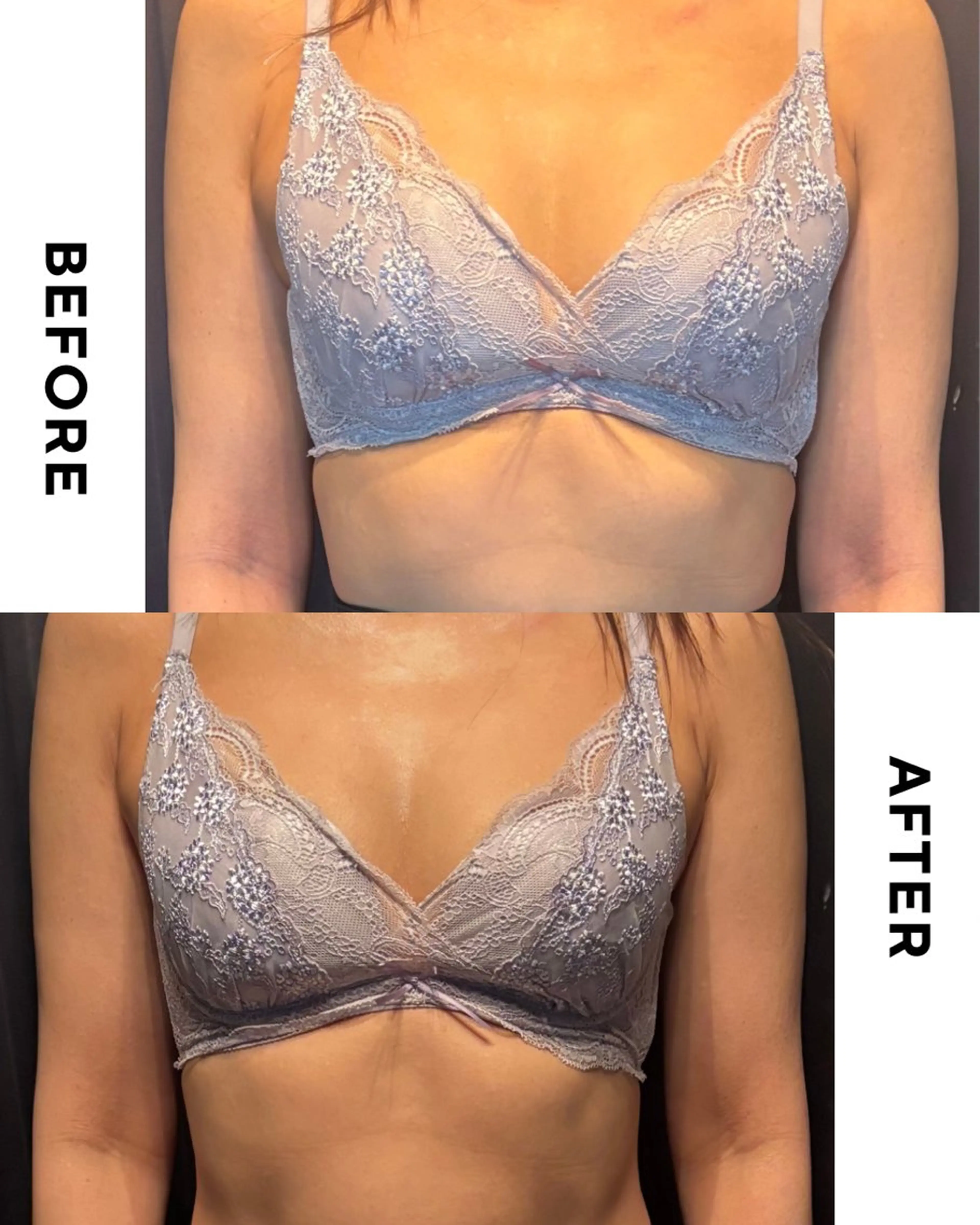 エステ private salon Rions所属・堺市バストアップ特化 サロンRIONSのエステ・リラクイメージ