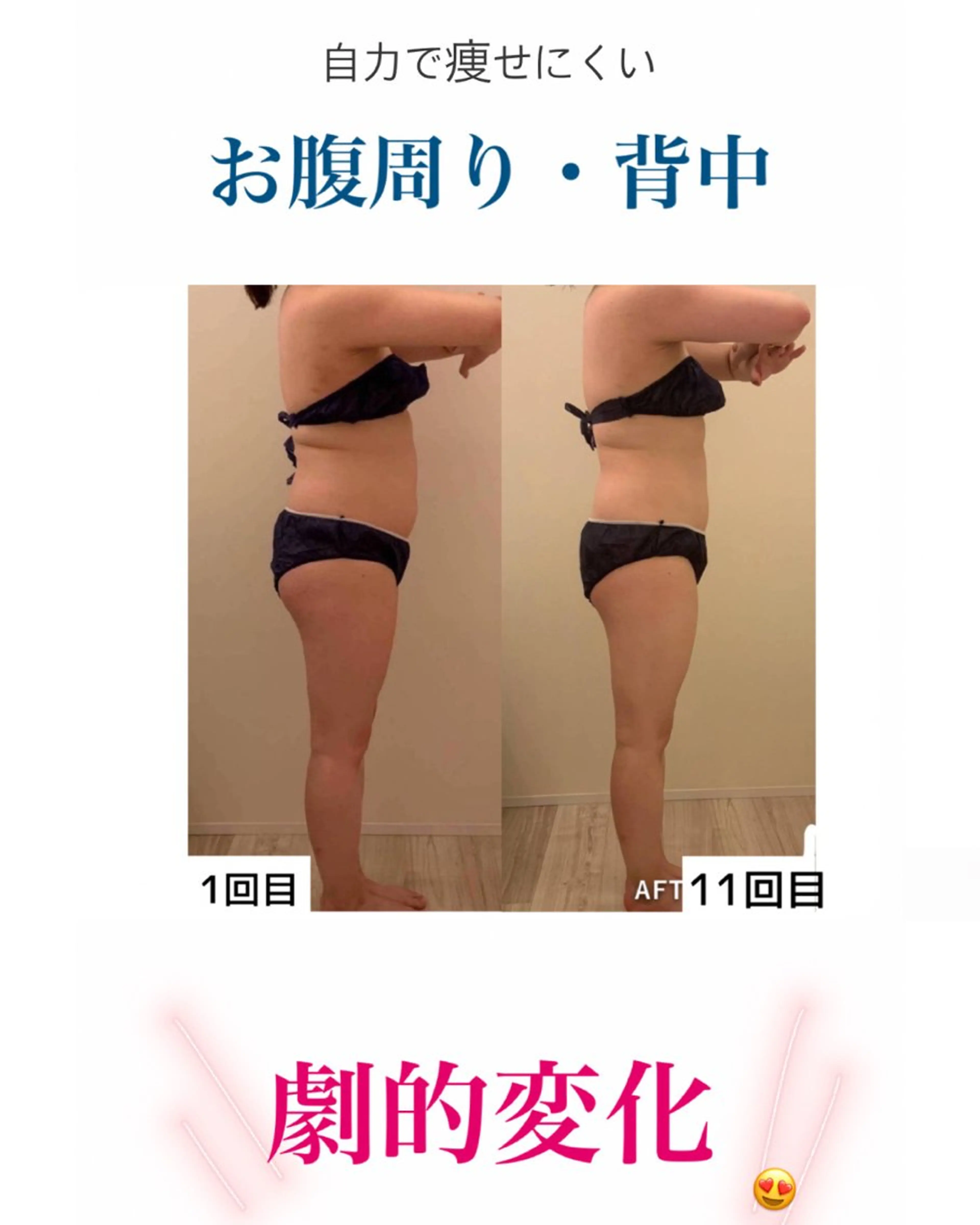 産後ダイエット−9㎏ Pourvous結衣のエステ・リラクイメージ