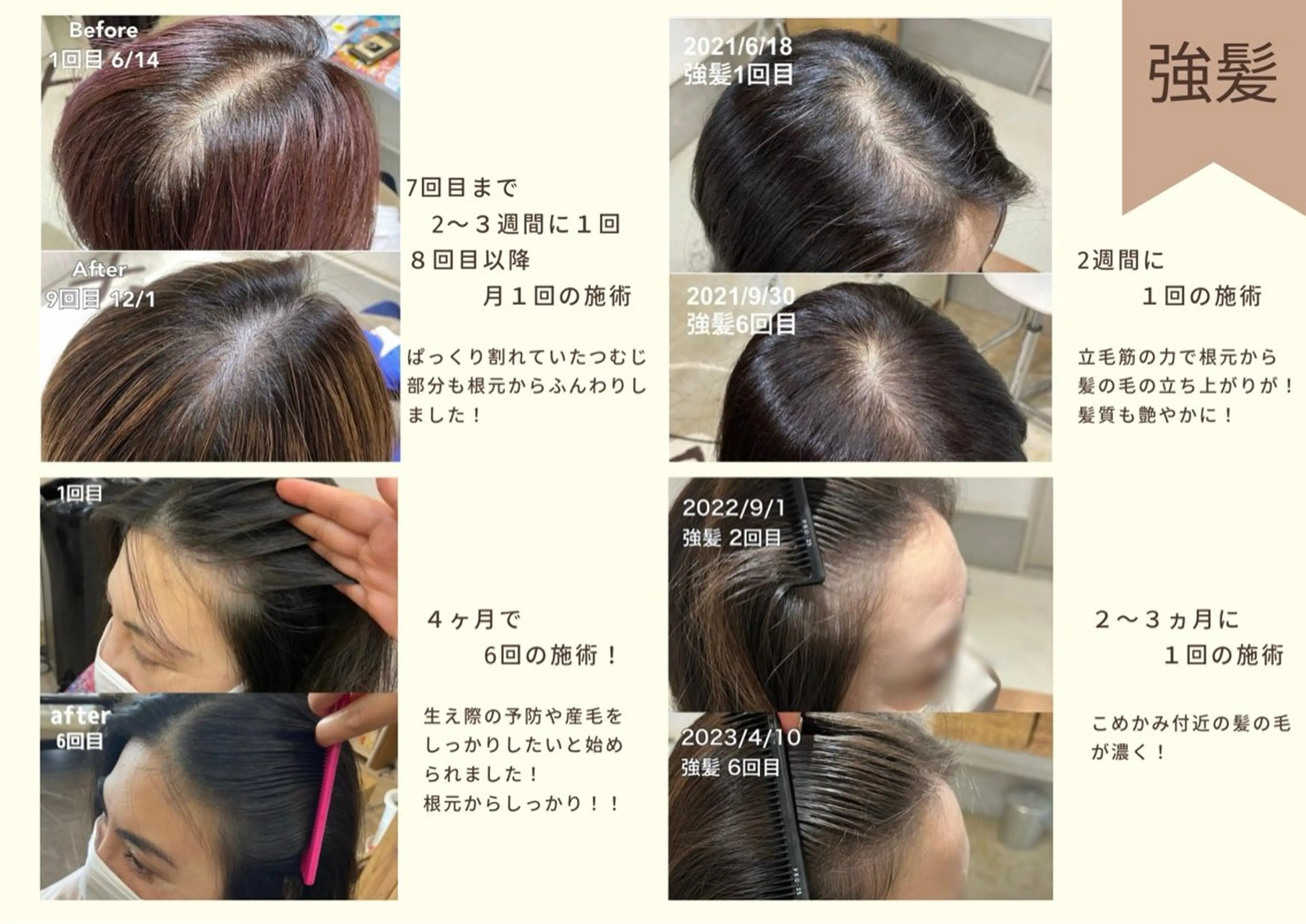 トリートメント ヘッドスパ 痩身・脱毛・美髪ケア 【GLYCINE】のエステ・リラクイメージ