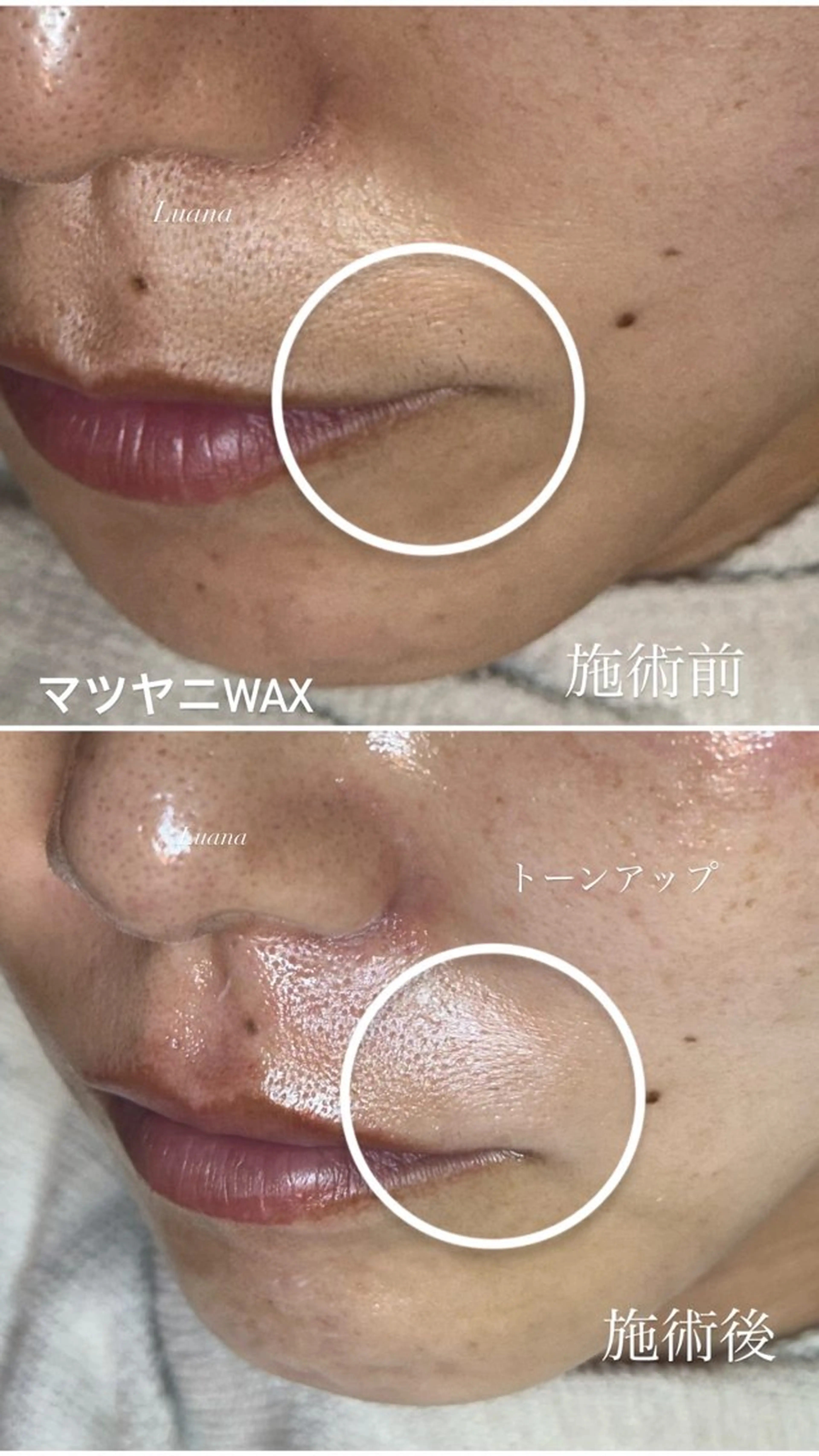 マツヤニWax専門/ 岸和田/Luanaのエステ・リラクイメージ