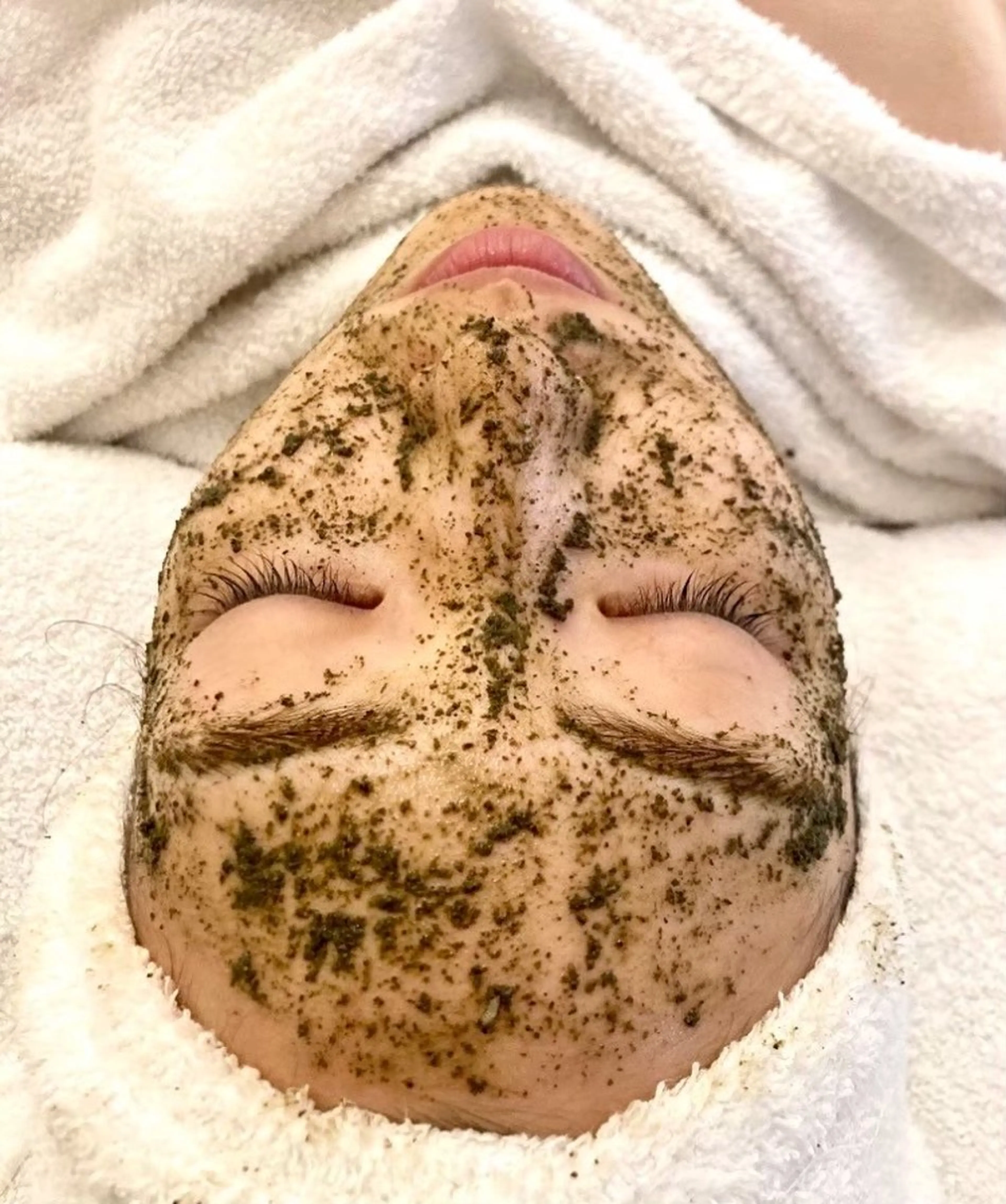 ハーブピーリング+冷感ドライヘッドスパ30分の写真