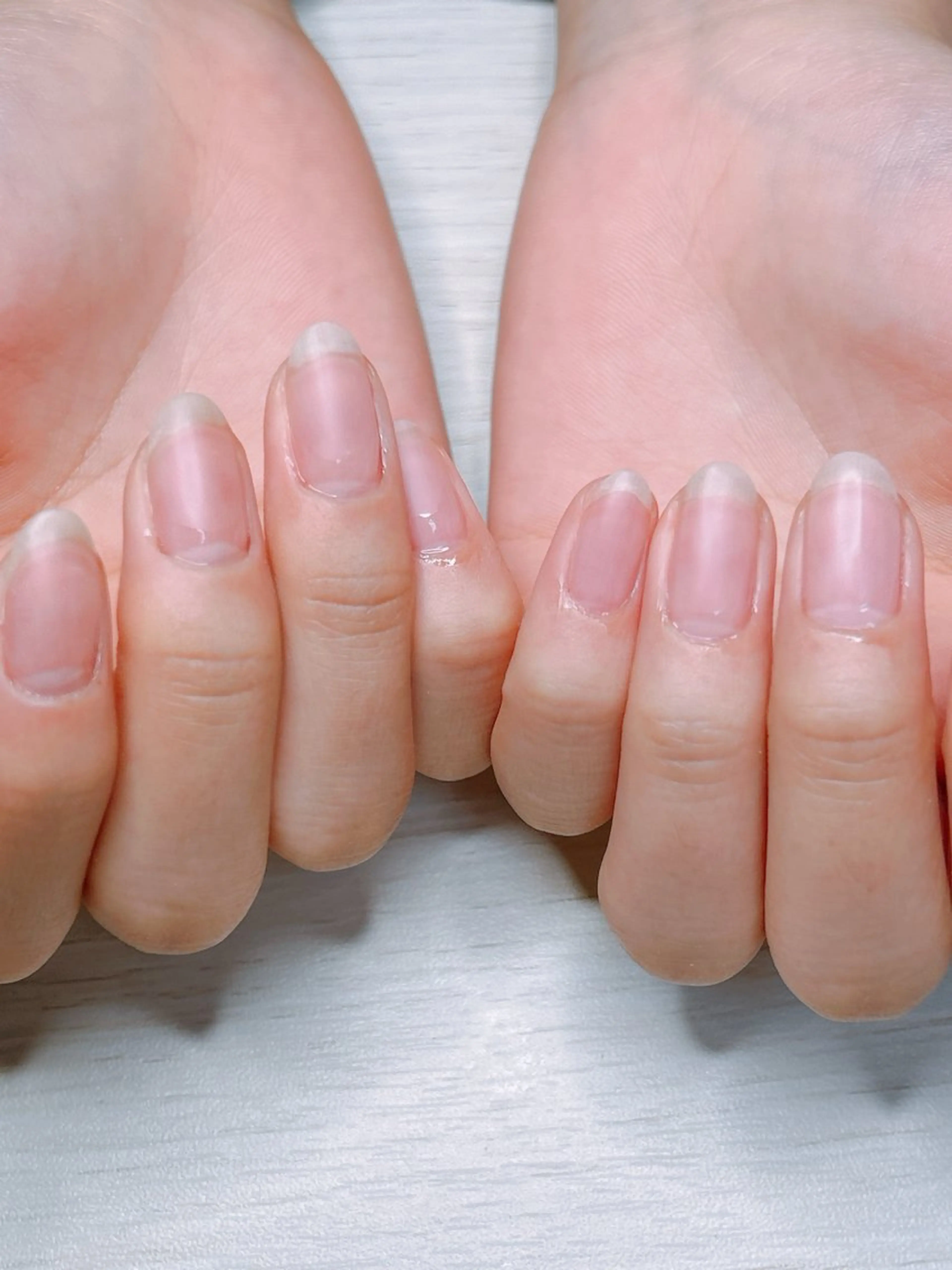 自爪風クリアネイルの写真