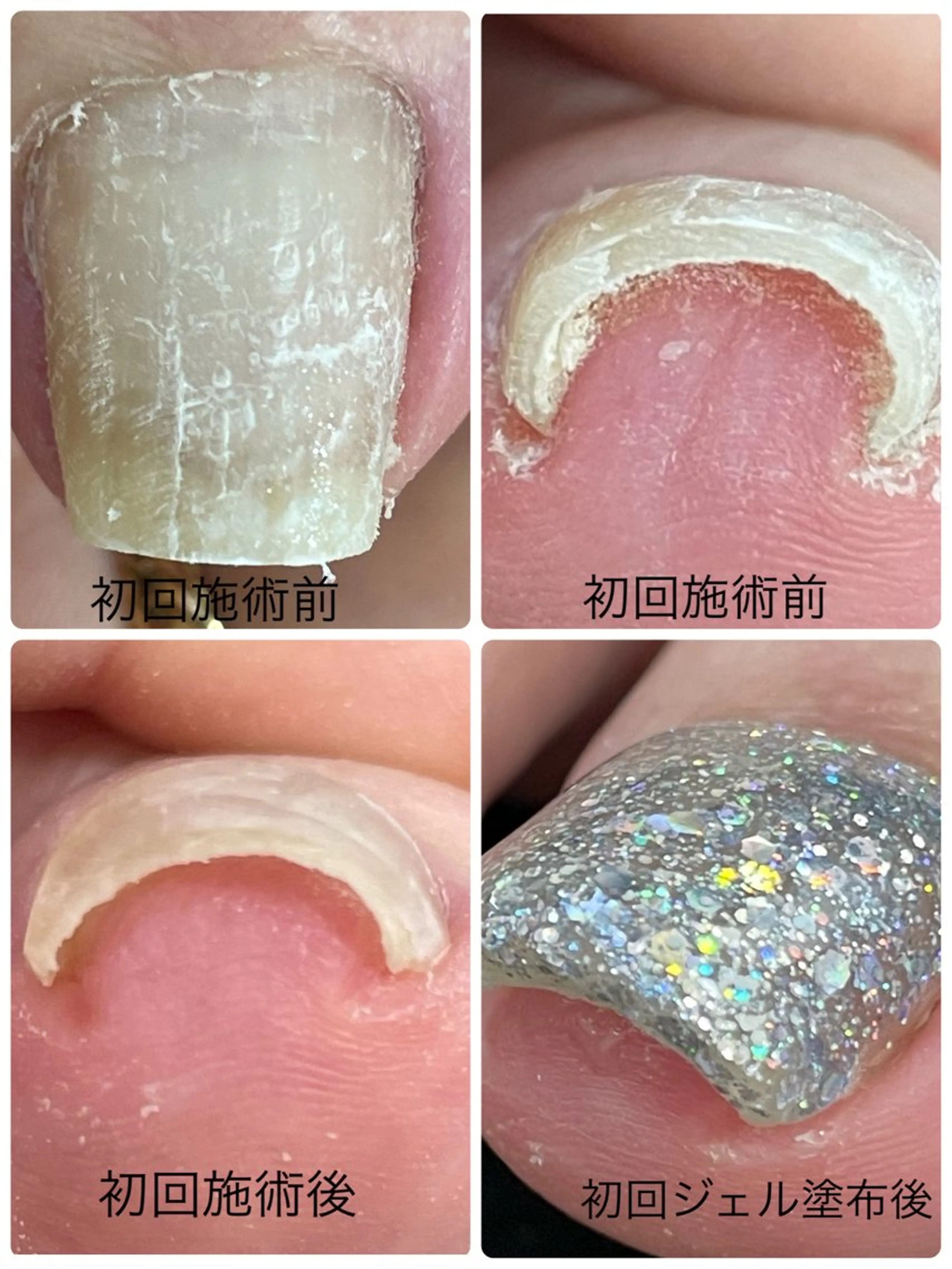 ネイル R*NAIL .comのネイルデザイン