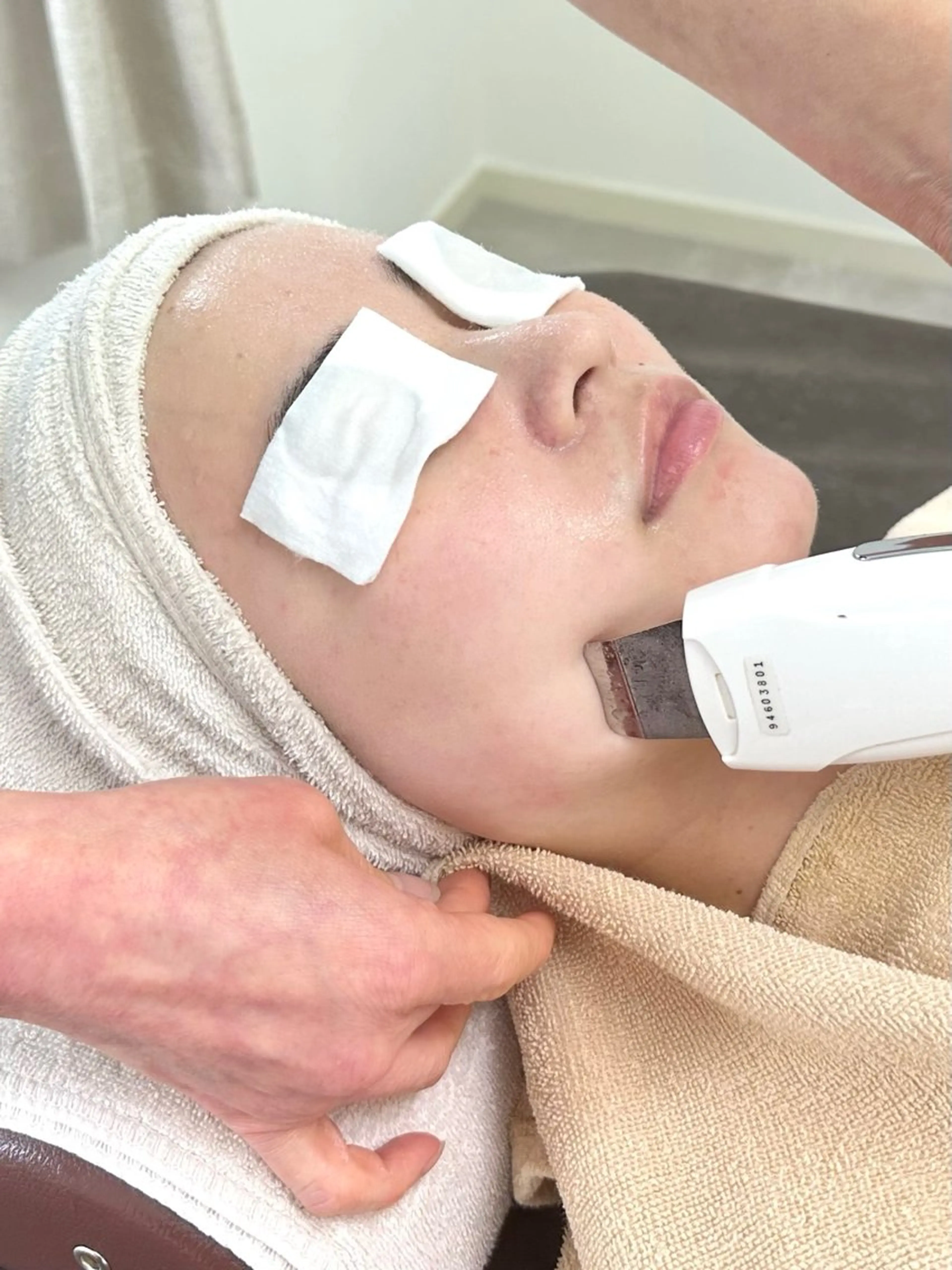 【超音波毛穴洗浄+モデリングパック】毛穴/ざらつき/くすみ/肌荒れ/ニキビの写真