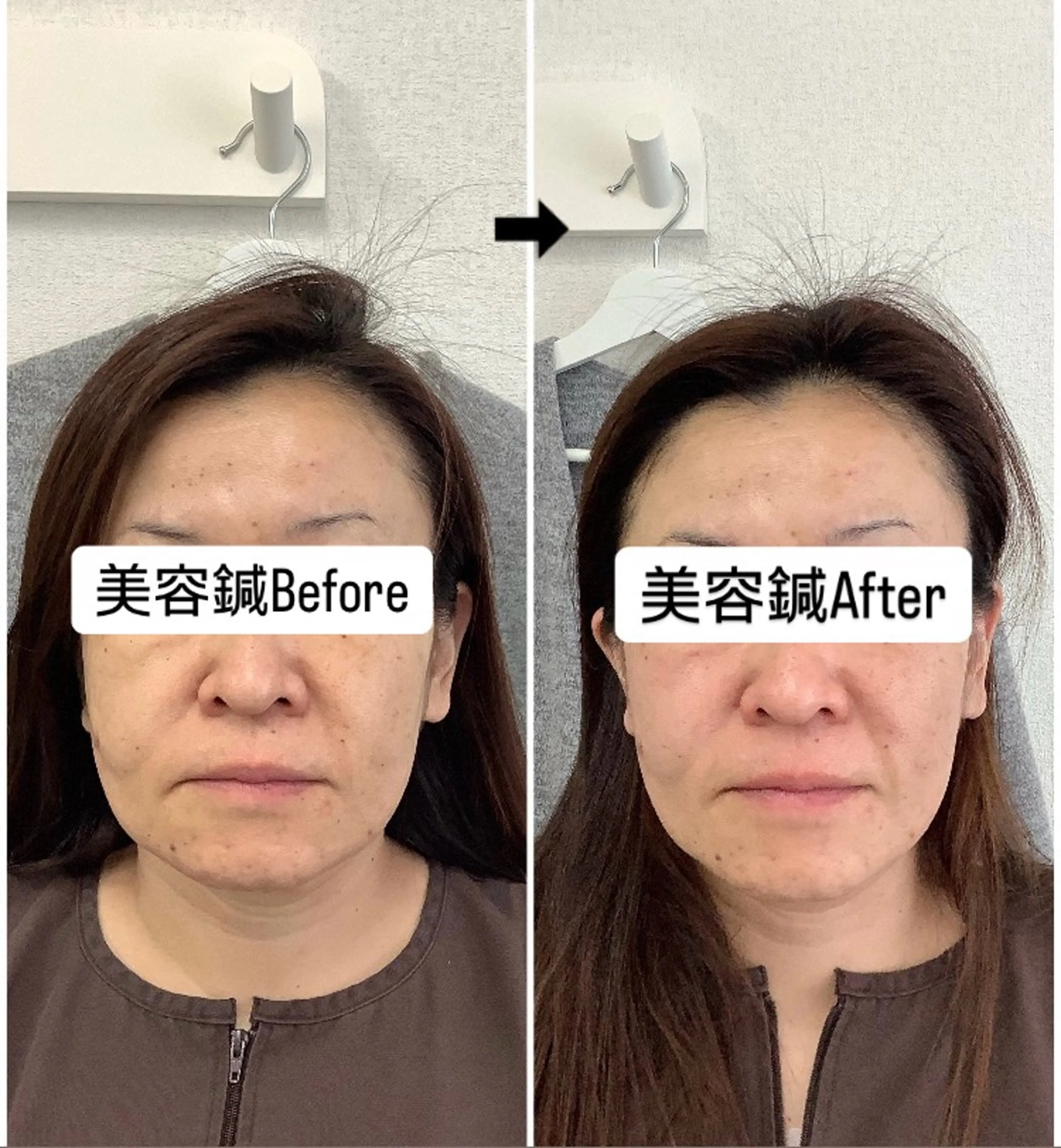 エステ リラク hari salon de off　美容鍼灸×小顔整体【ハリサロンドオフ】所属・美容鍼灸×小顔整体♡ ハリサロンドオフ堺東のエステ・リラクイメージ