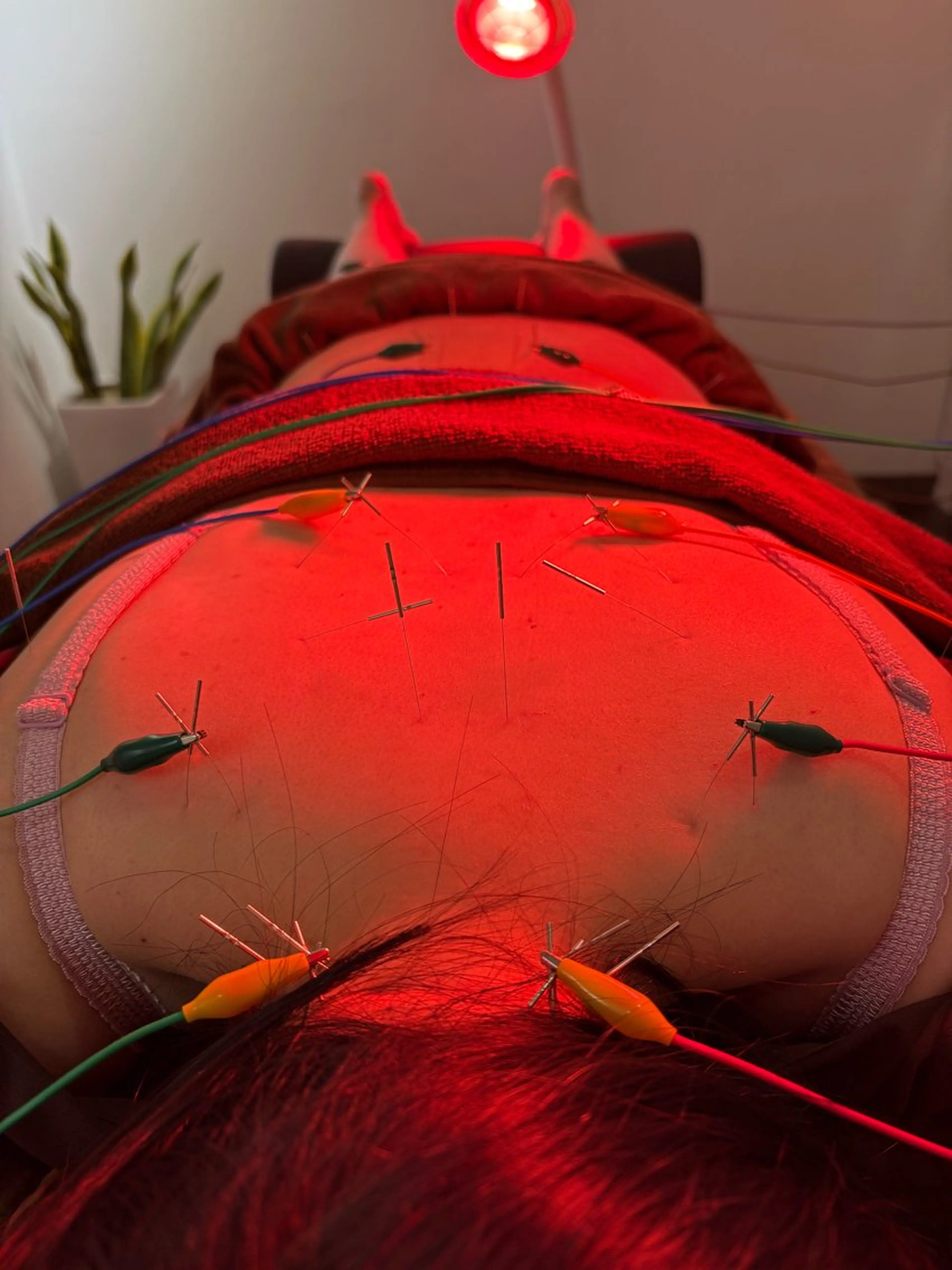 エステ リラク Spring鍼灸院所属・Spring鍼灸院 ✨首肩こり、腰痛に！のエステ・リラクイメージ