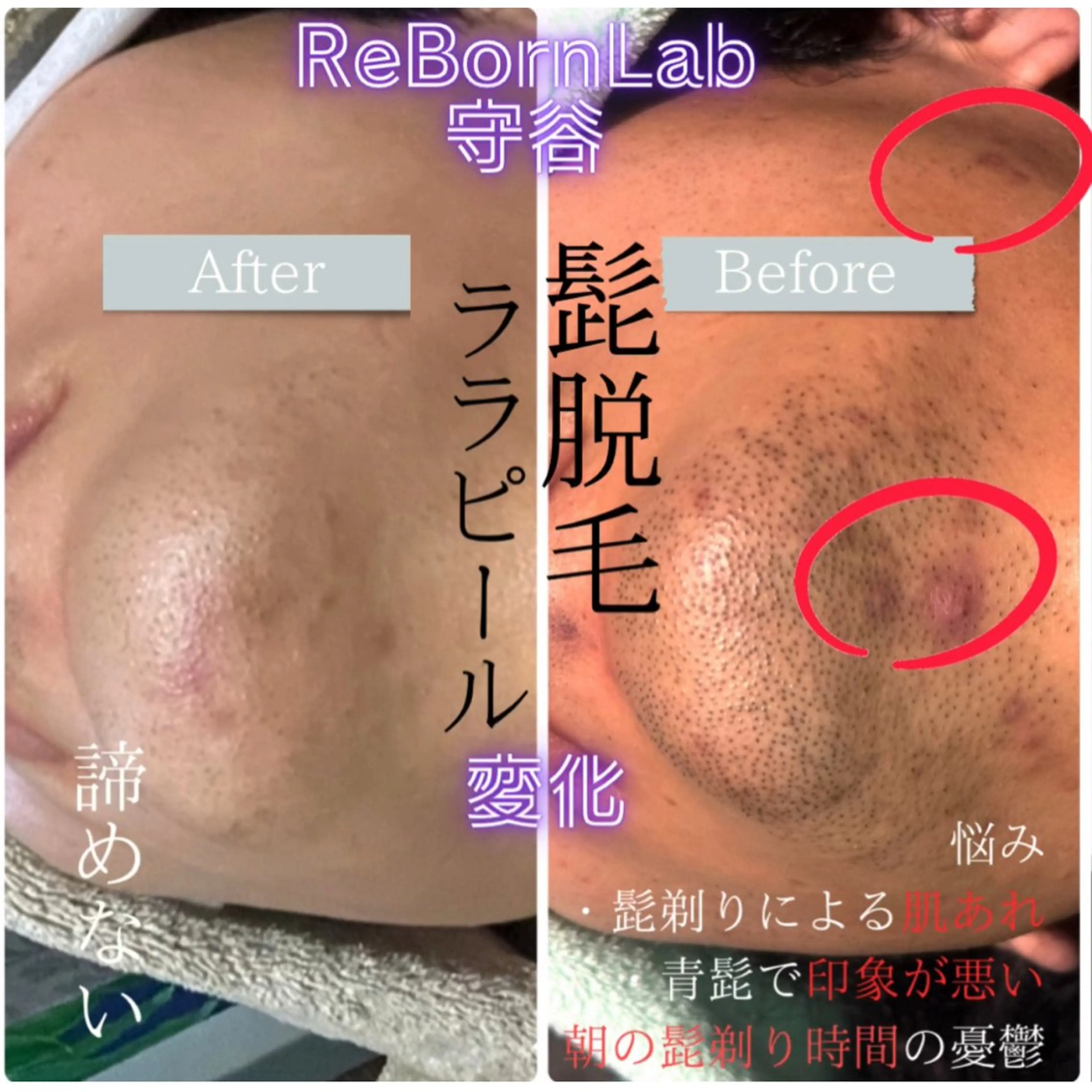 メンズ ReBorn  Lab所属・リボーン ラボのエステ・リラクイメージ