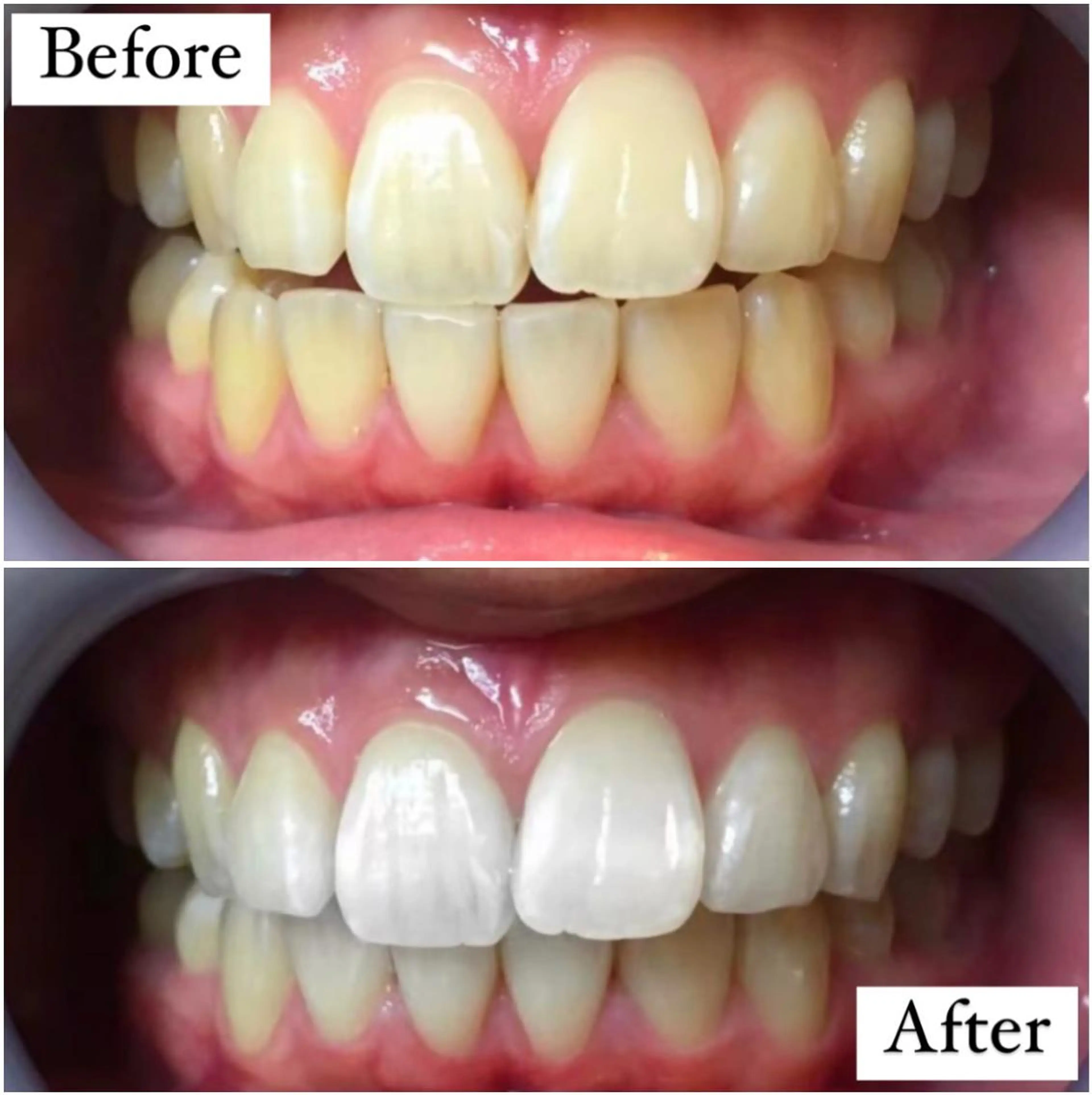 LBSホワイトニング 🌐渋谷店 小河原のエステ・リラクイメージ