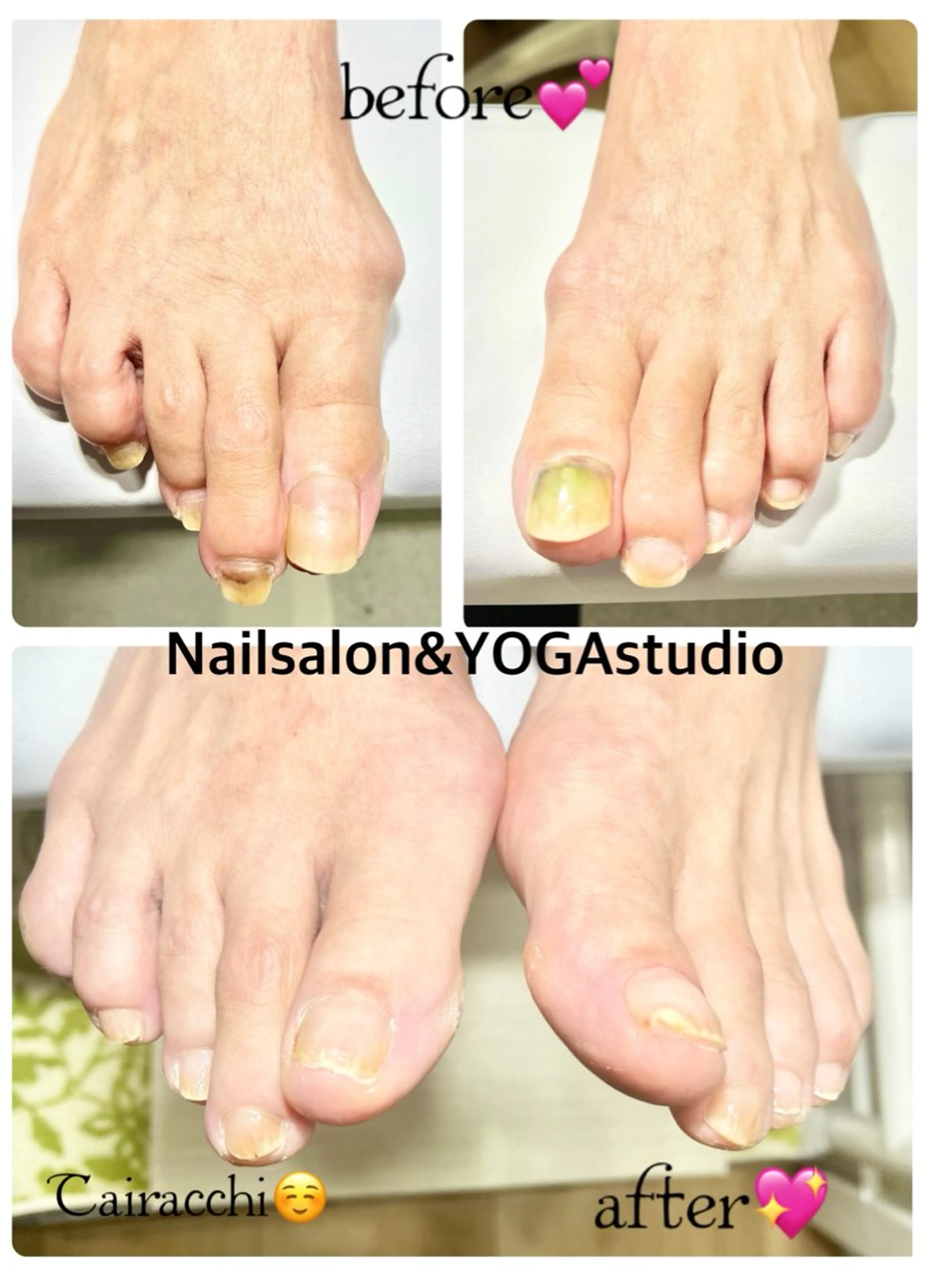 ネイル フットネイル ジェルネイル ハンドケア Tairacchi ﾀｲﾗｯﾁのエステ・リラクイメージ